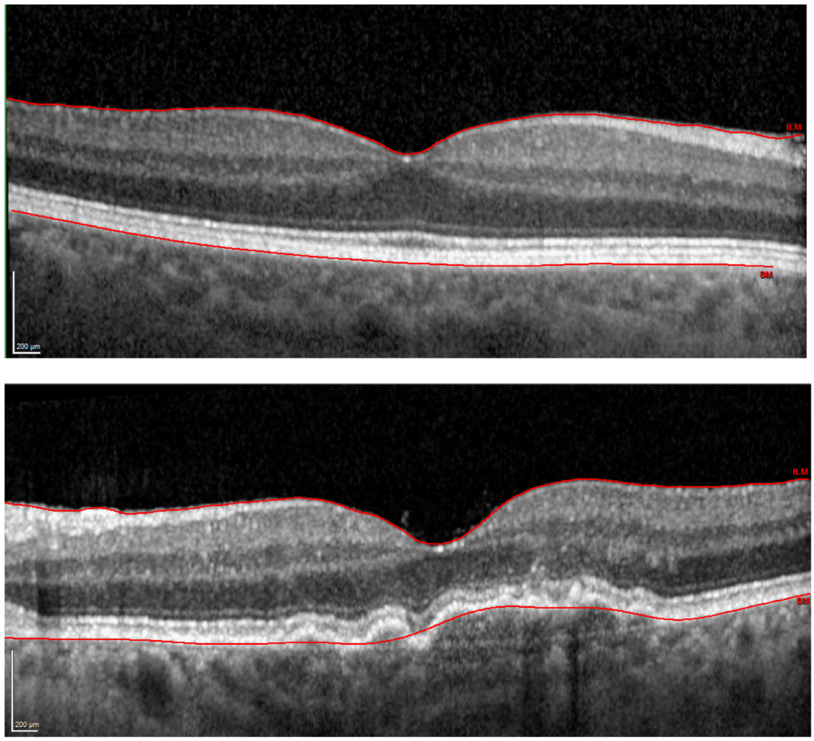 Diagnostics 12 00760 g001