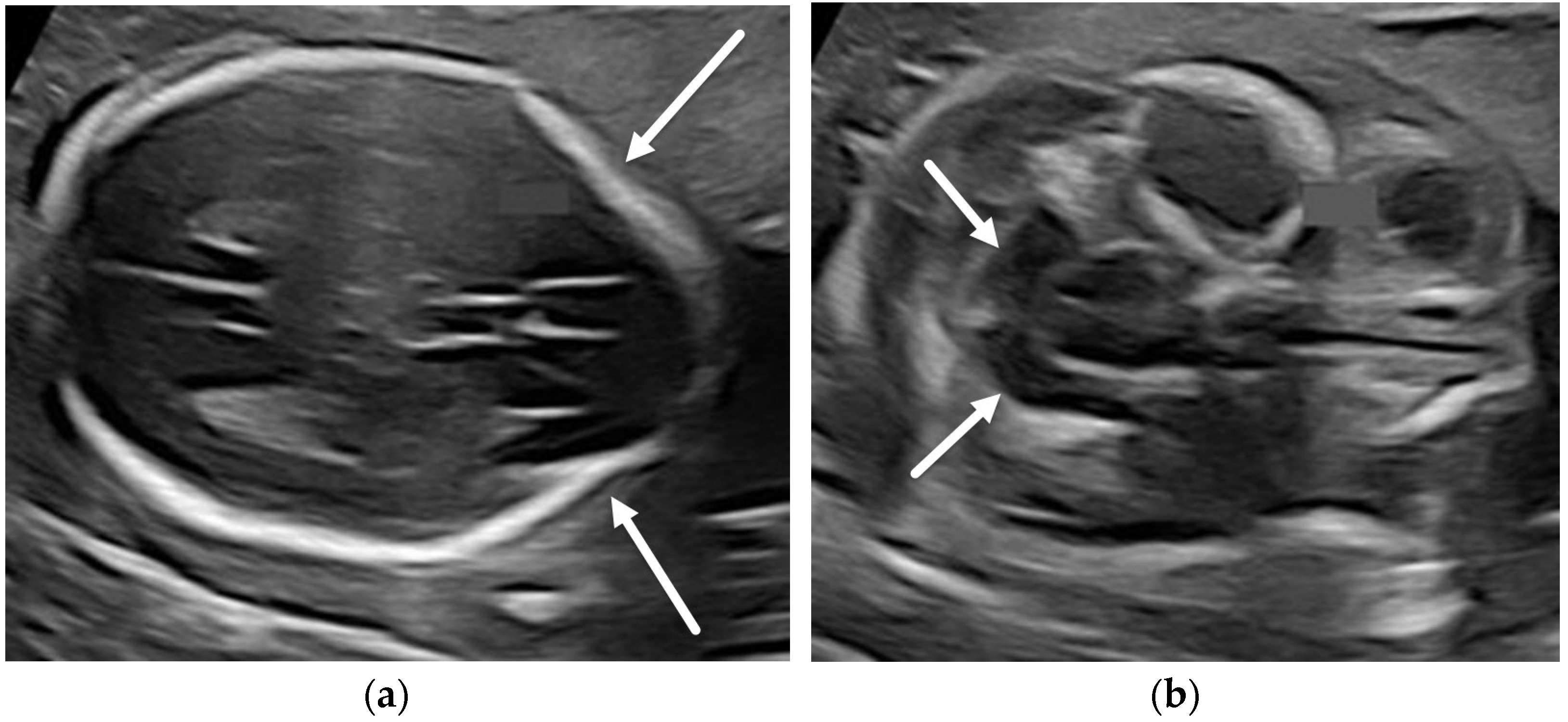 Diagnostics 12 00764 g003a