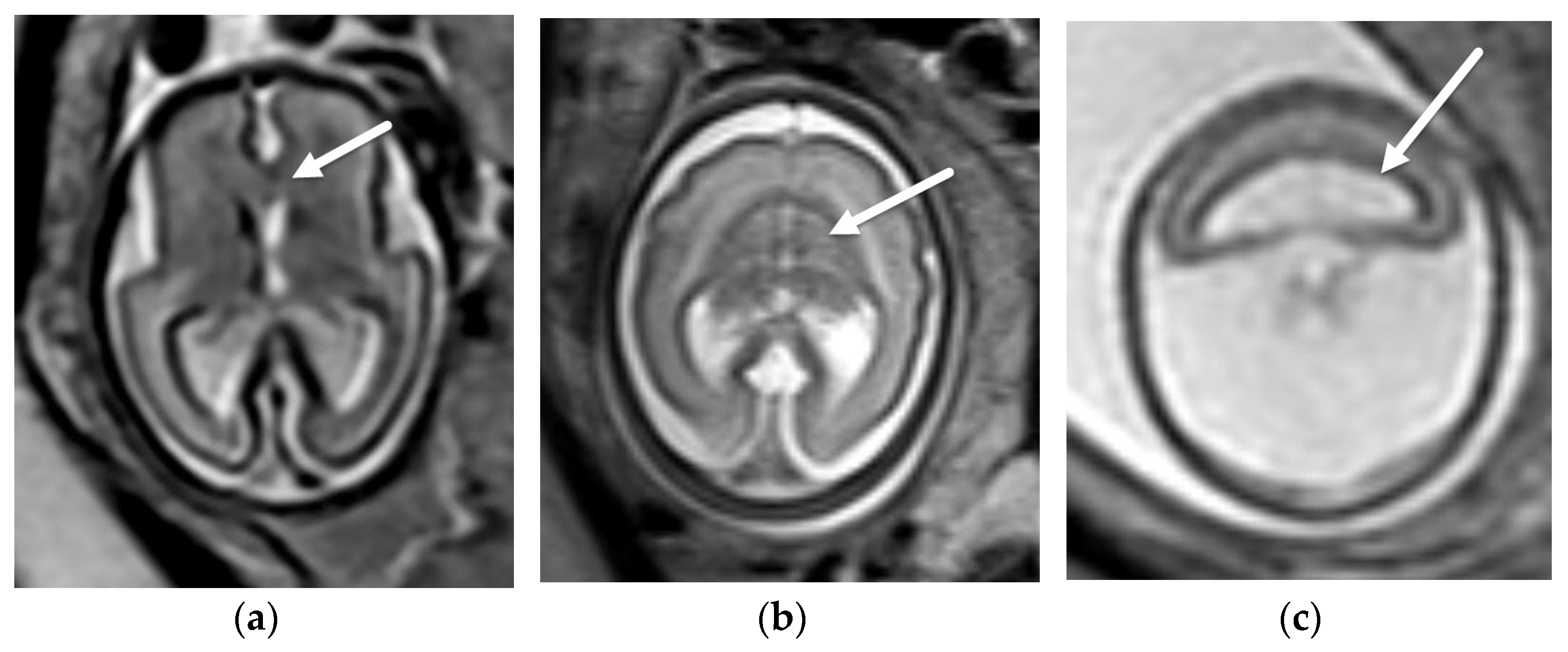 Diagnostics 12 00764 g005