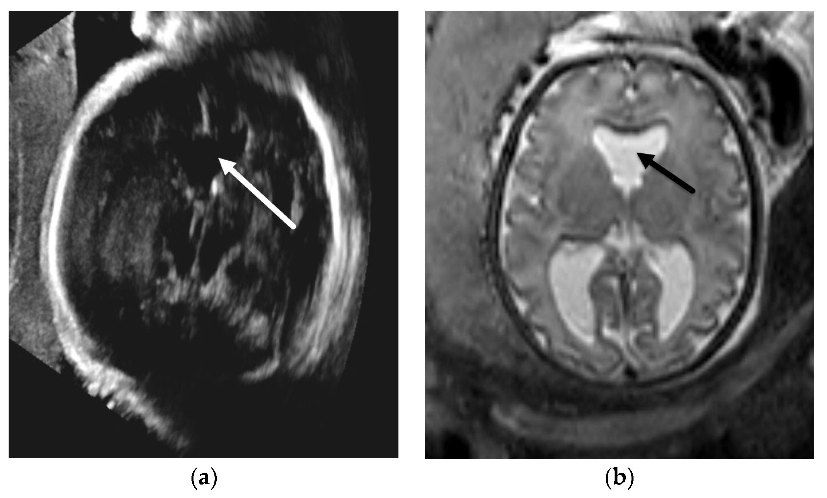 Diagnostics 12 00764 g007