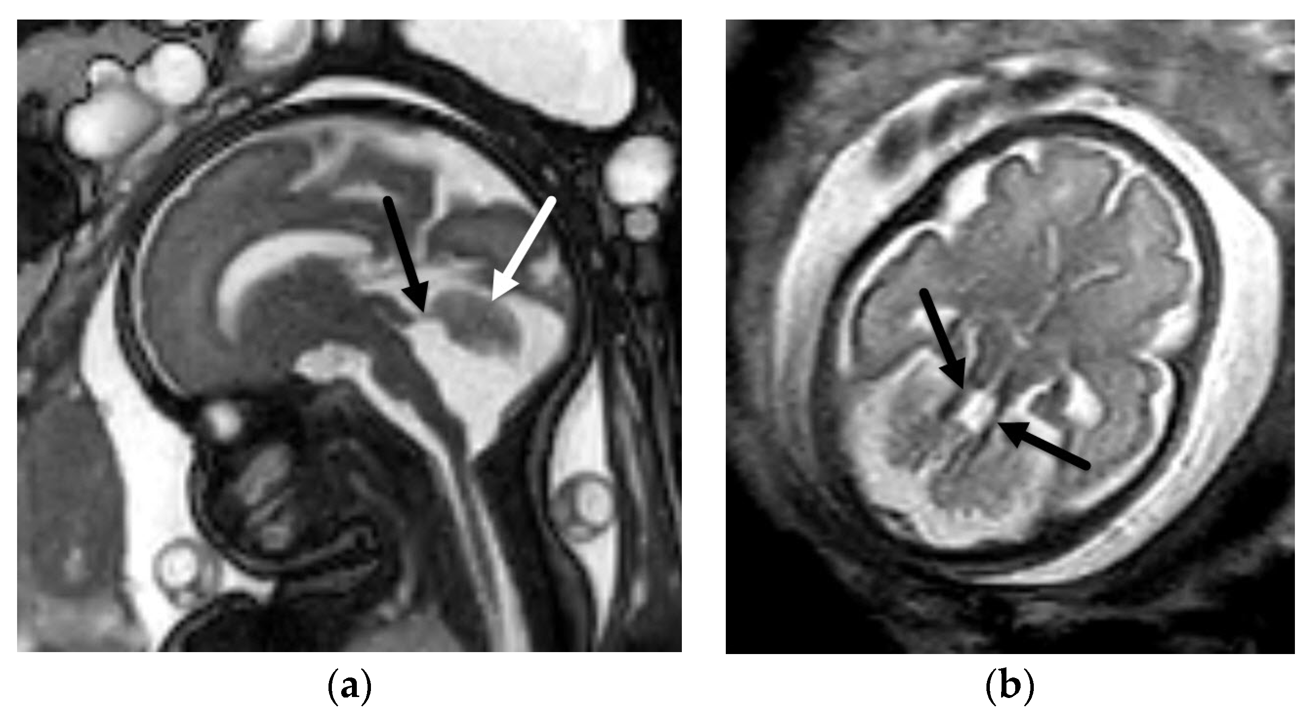 Diagnostics 12 00764 g010
