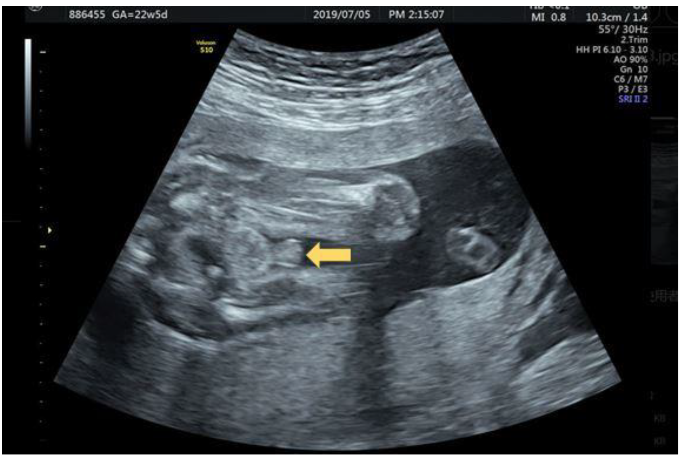 Diagnostics 12 00774 g002