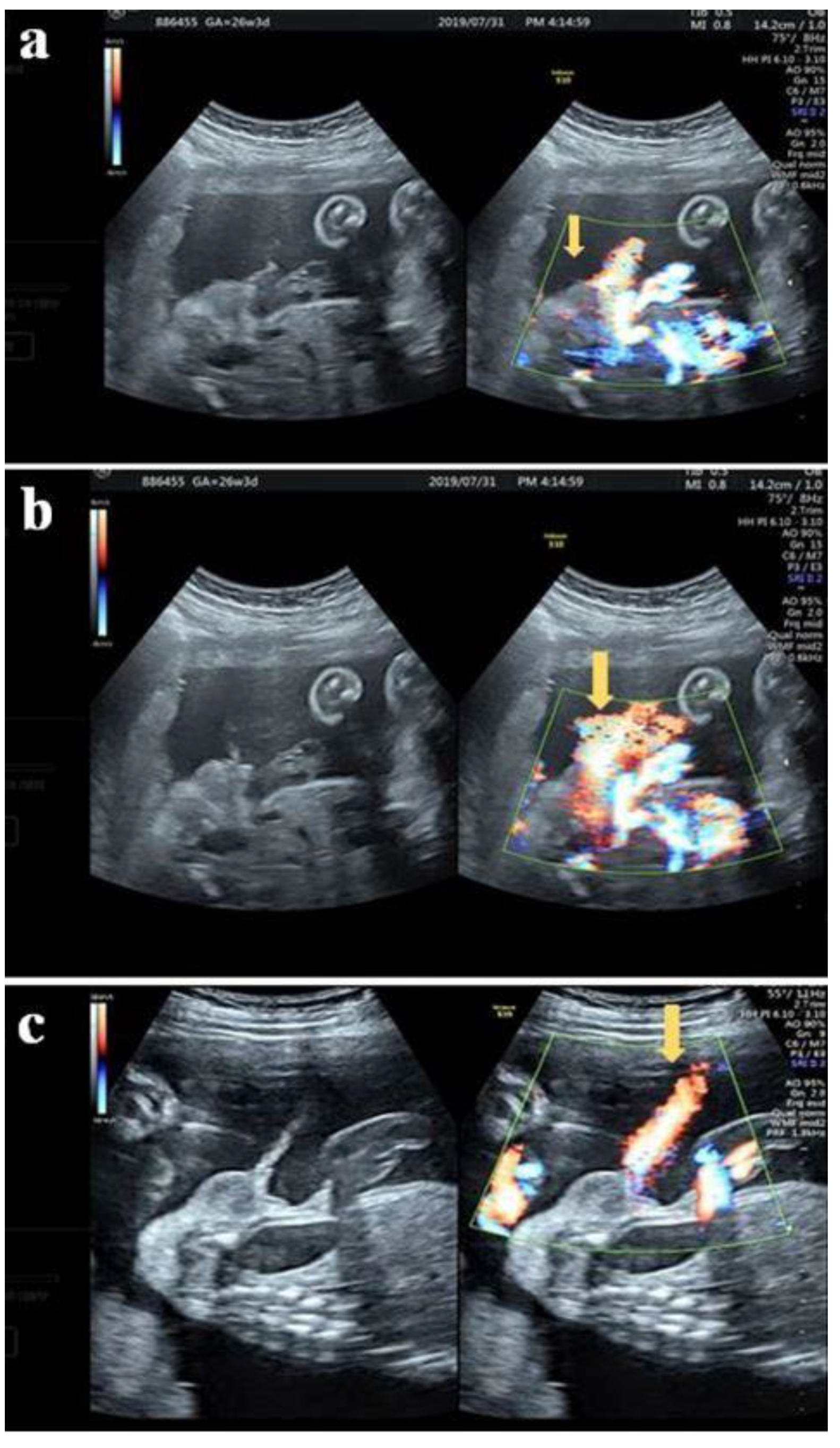 Diagnostics 12 00774 g003