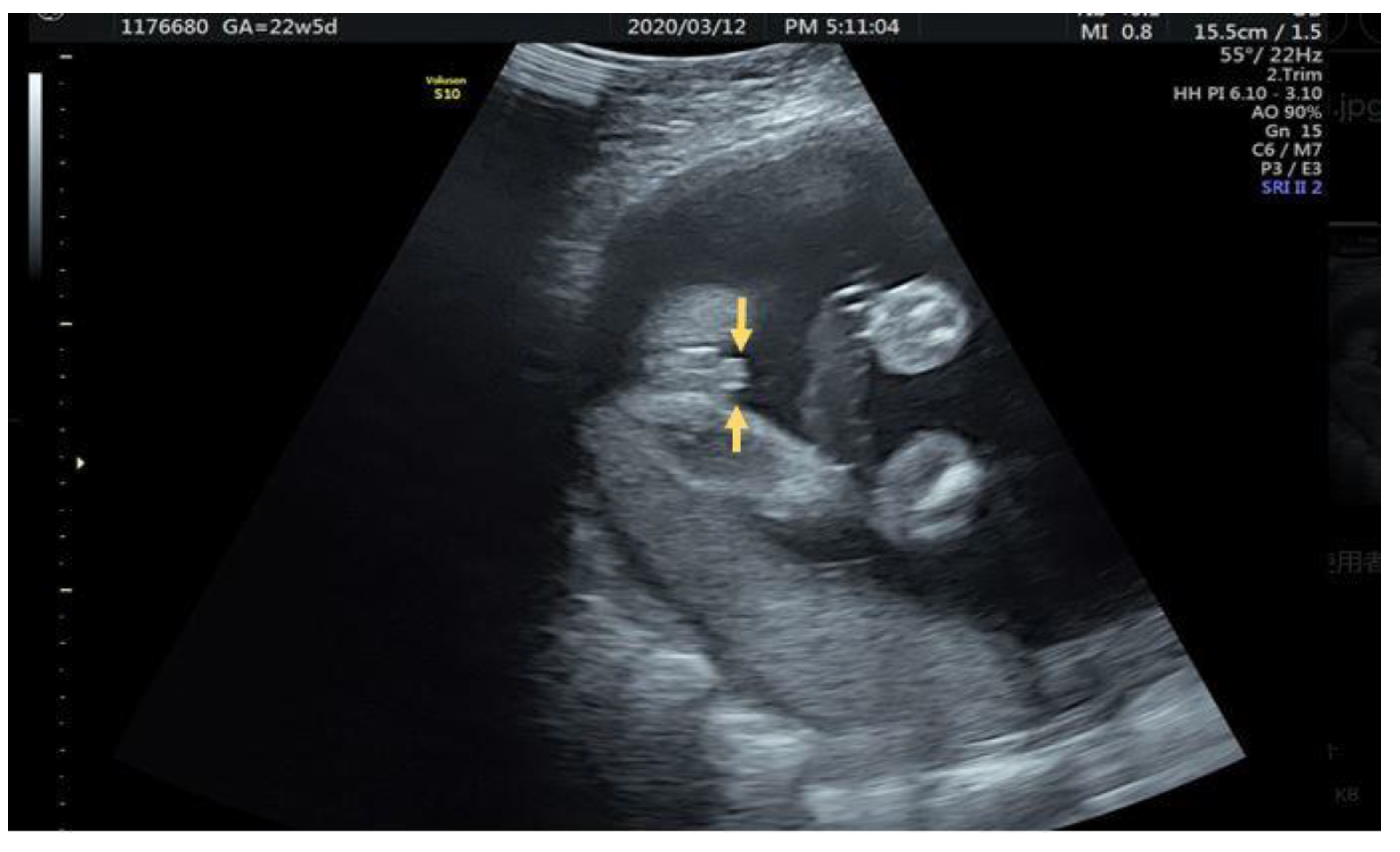 Diagnostics 12 00774 g005