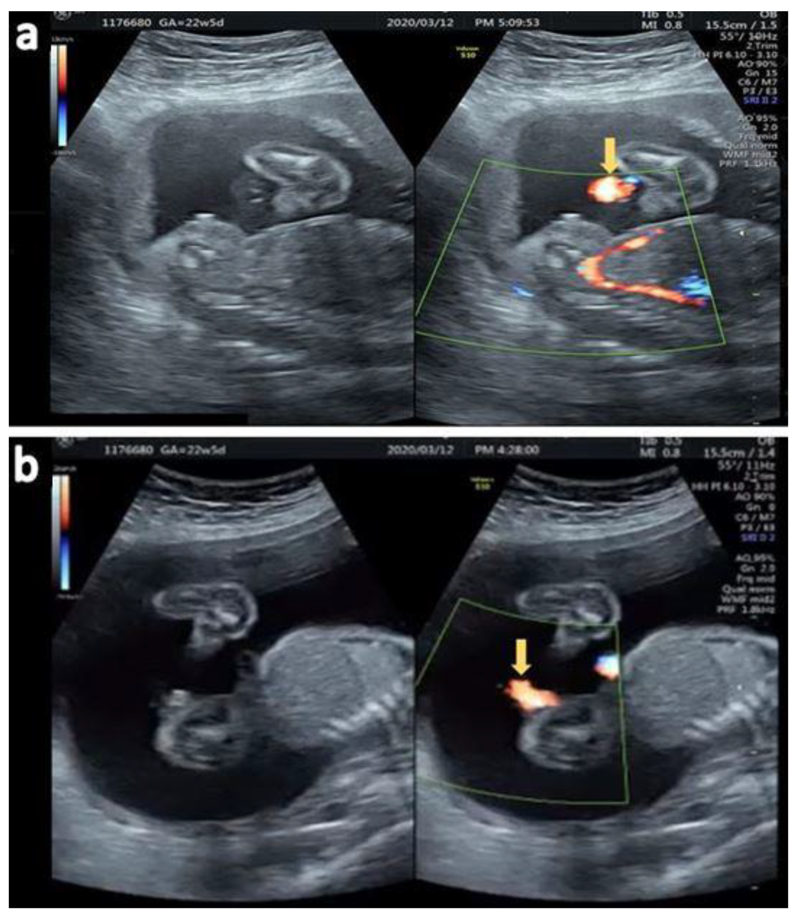 Diagnostics 12 00774 g006