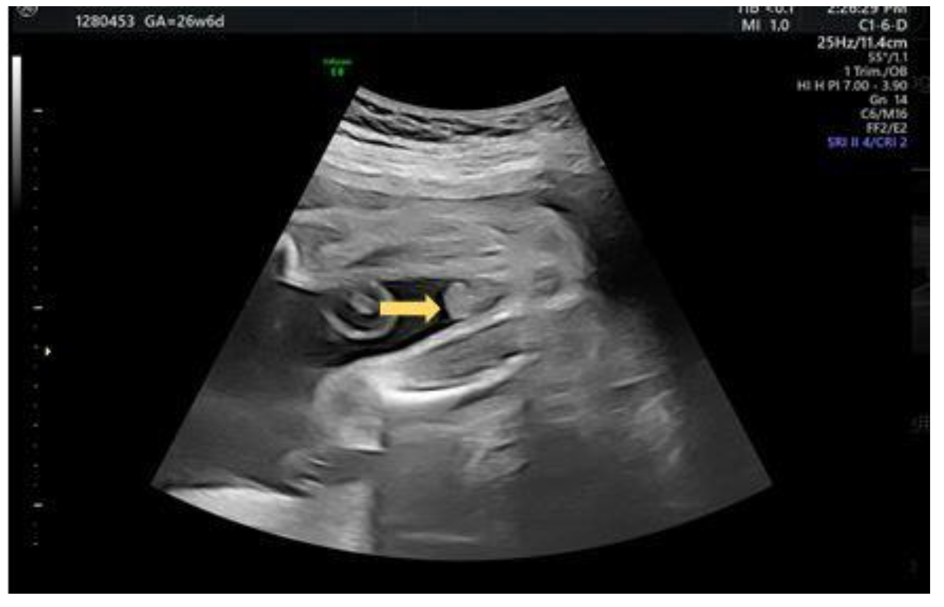 Diagnostics 12 00774 g007