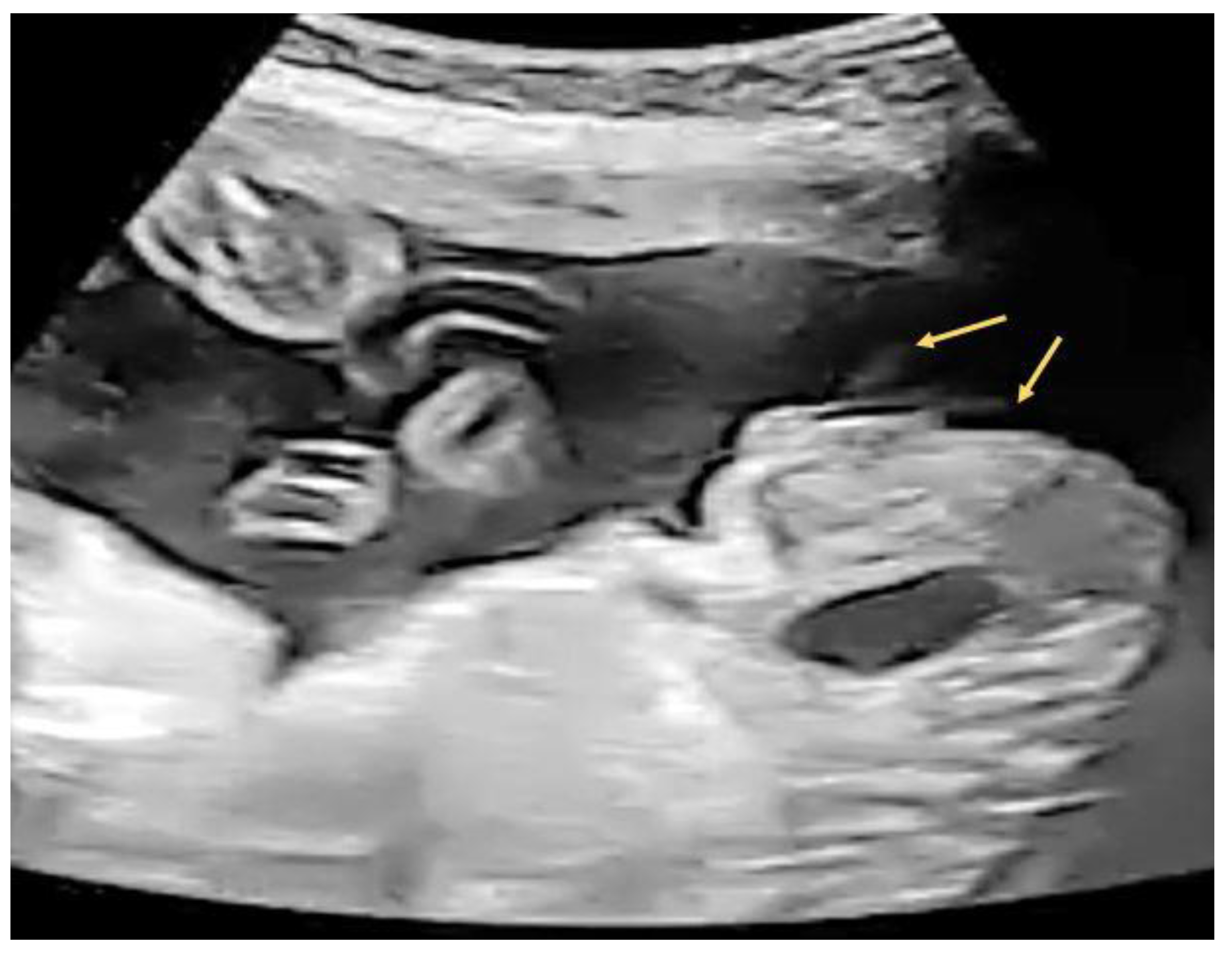 Diagnostics 12 00774 g008