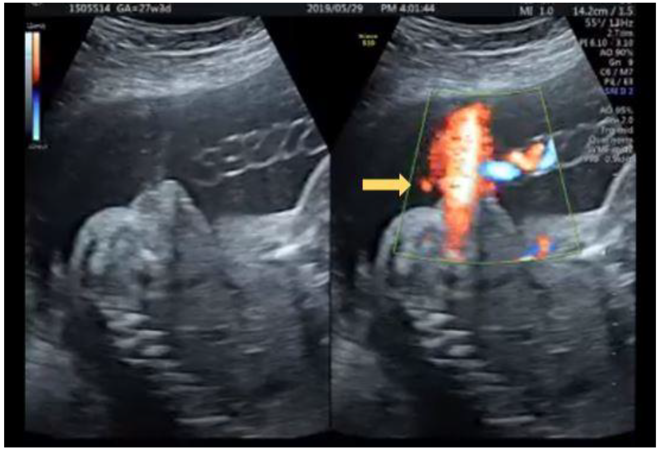 Diagnostics 12 00774 g011
