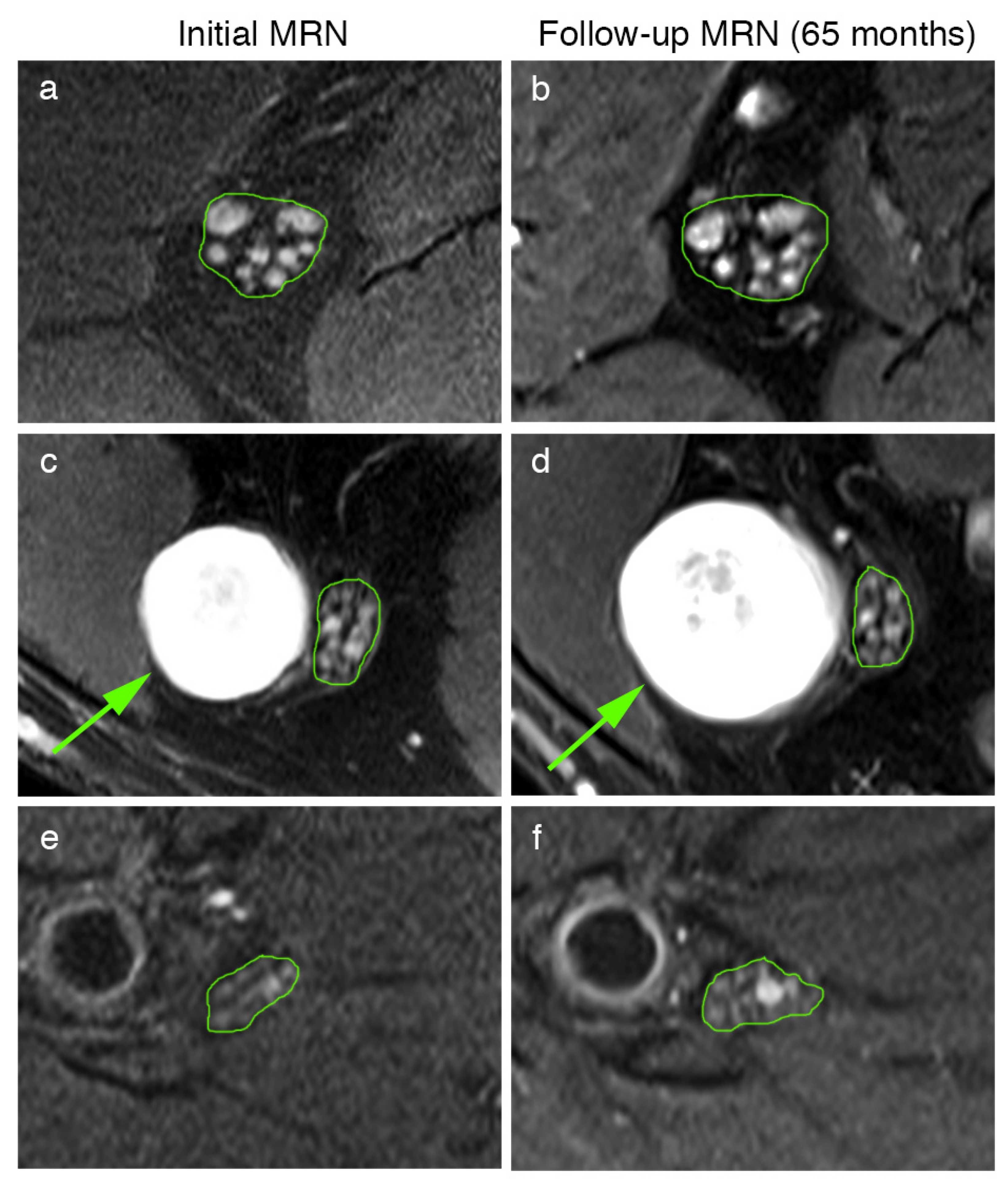 Diagnostics 12 00780 g003