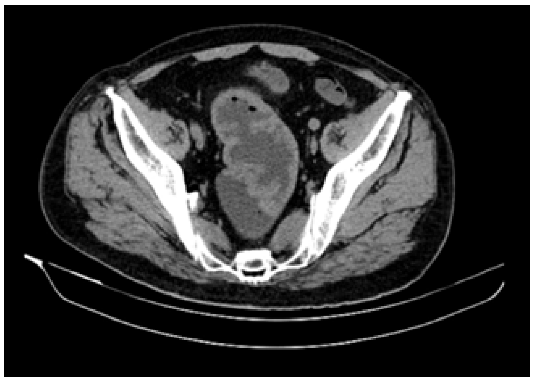 Diagnostics 12 00784 g003