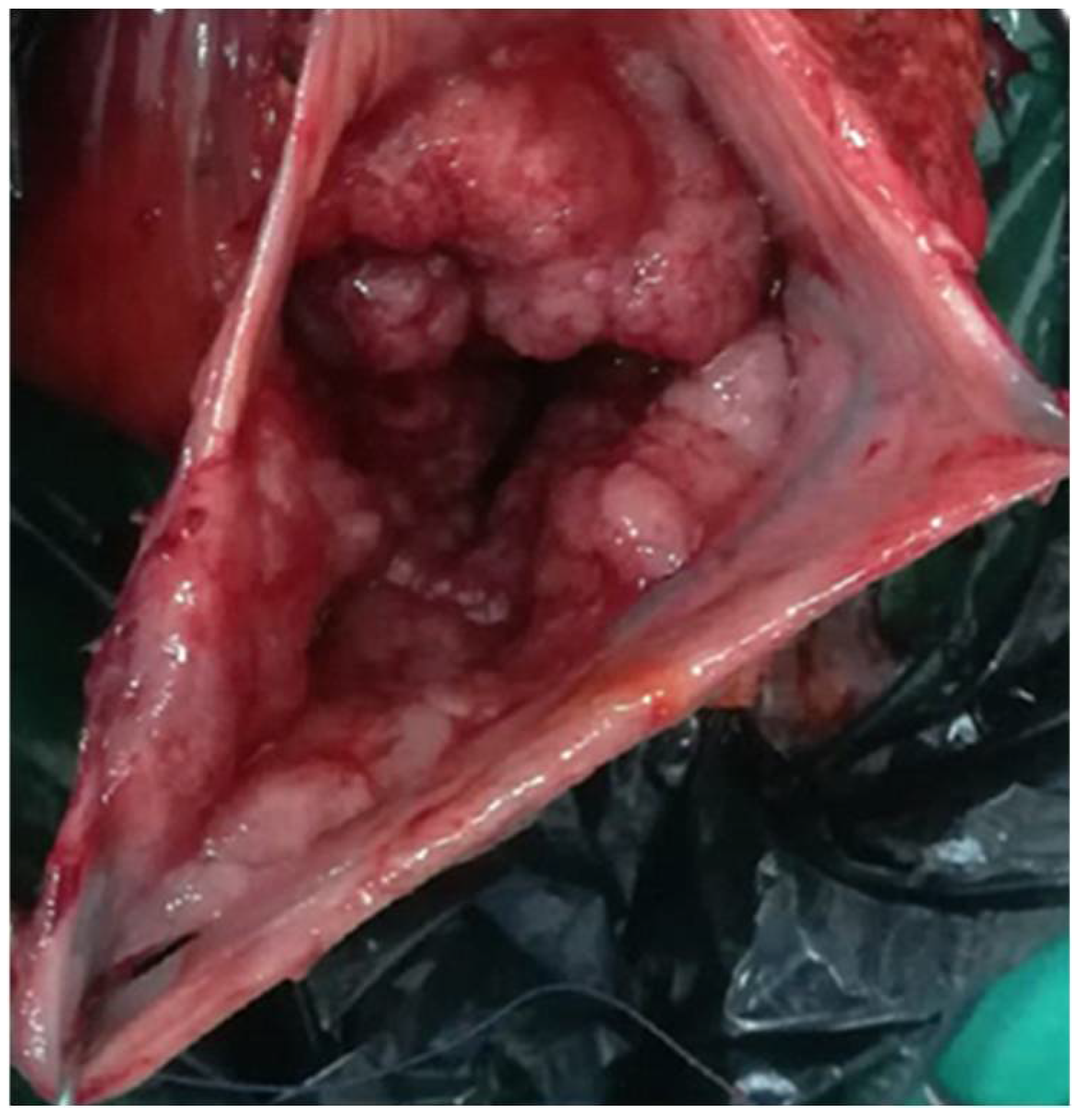 Diagnostics 12 00784 g004