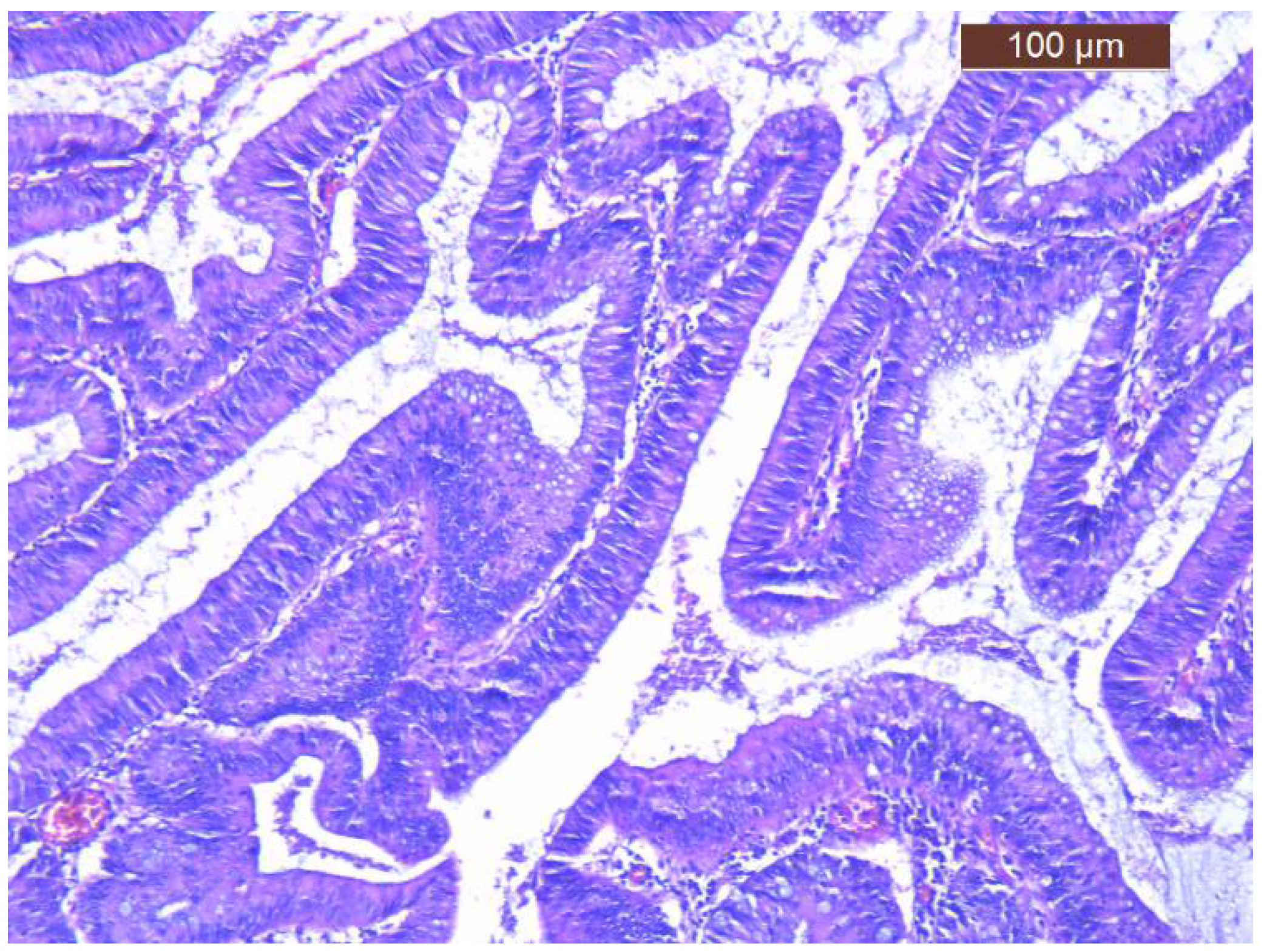Diagnostics 12 00784 g005