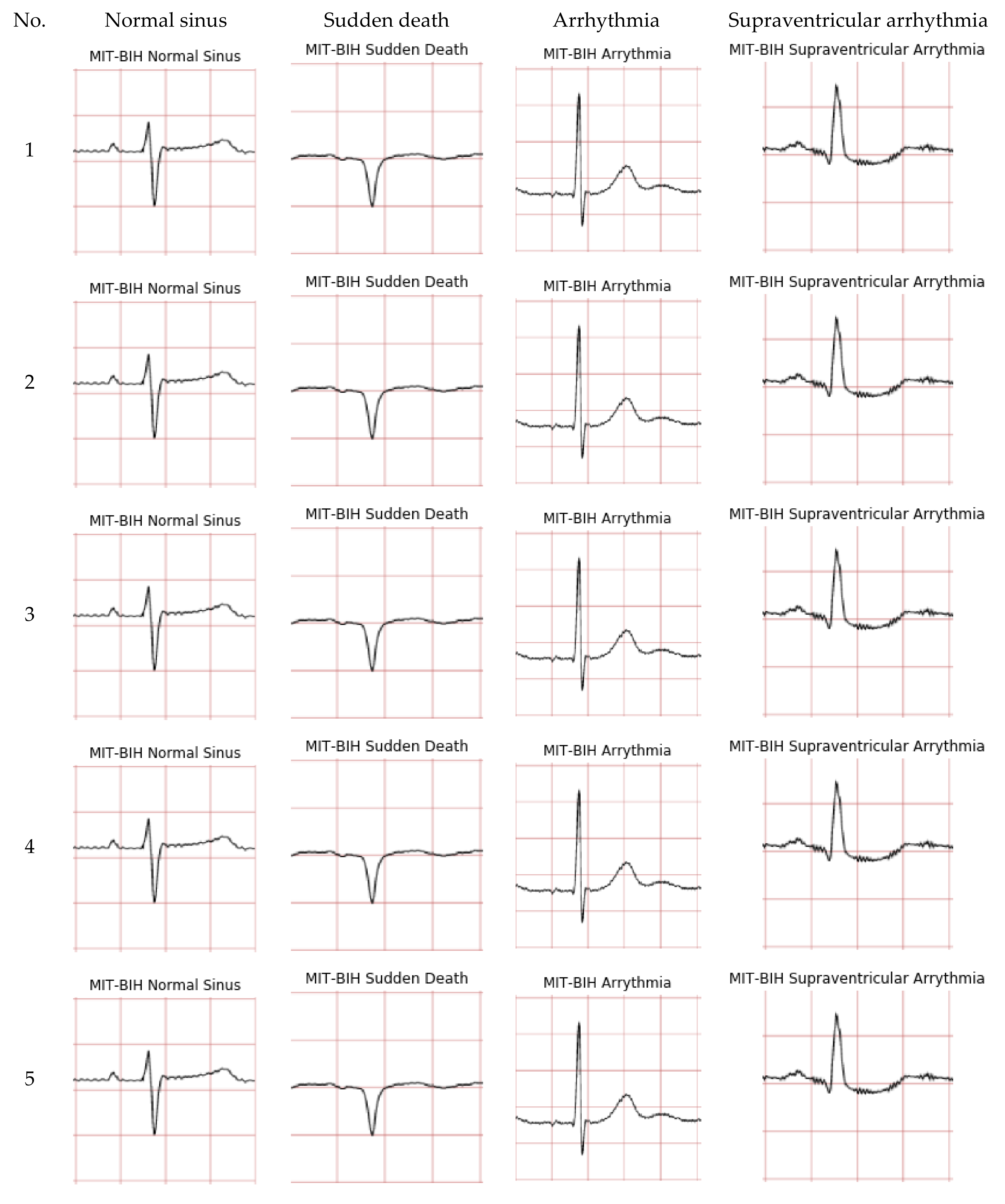 Diagnostics 12 00795 g005