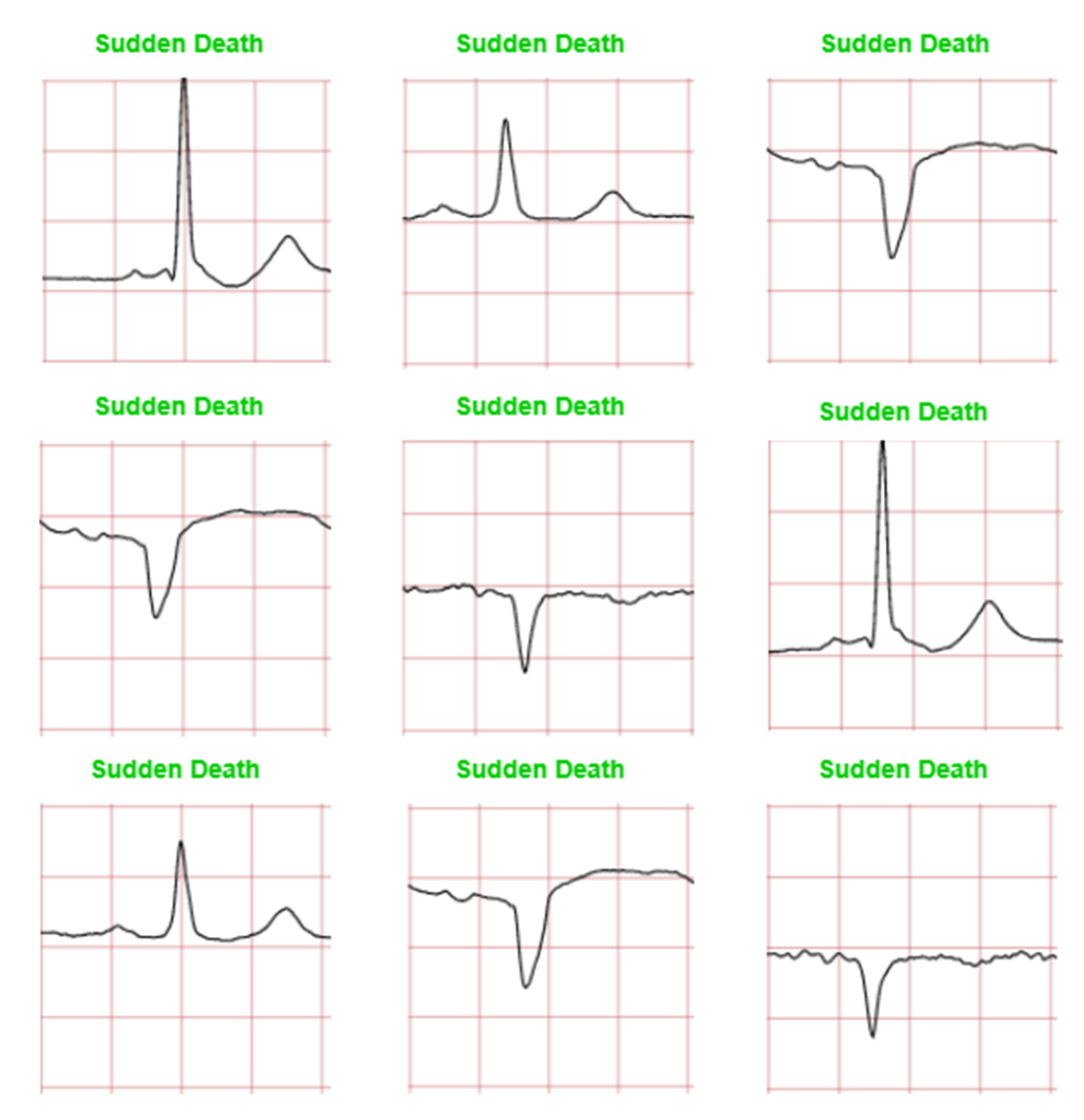 Diagnostics 12 00795 g012