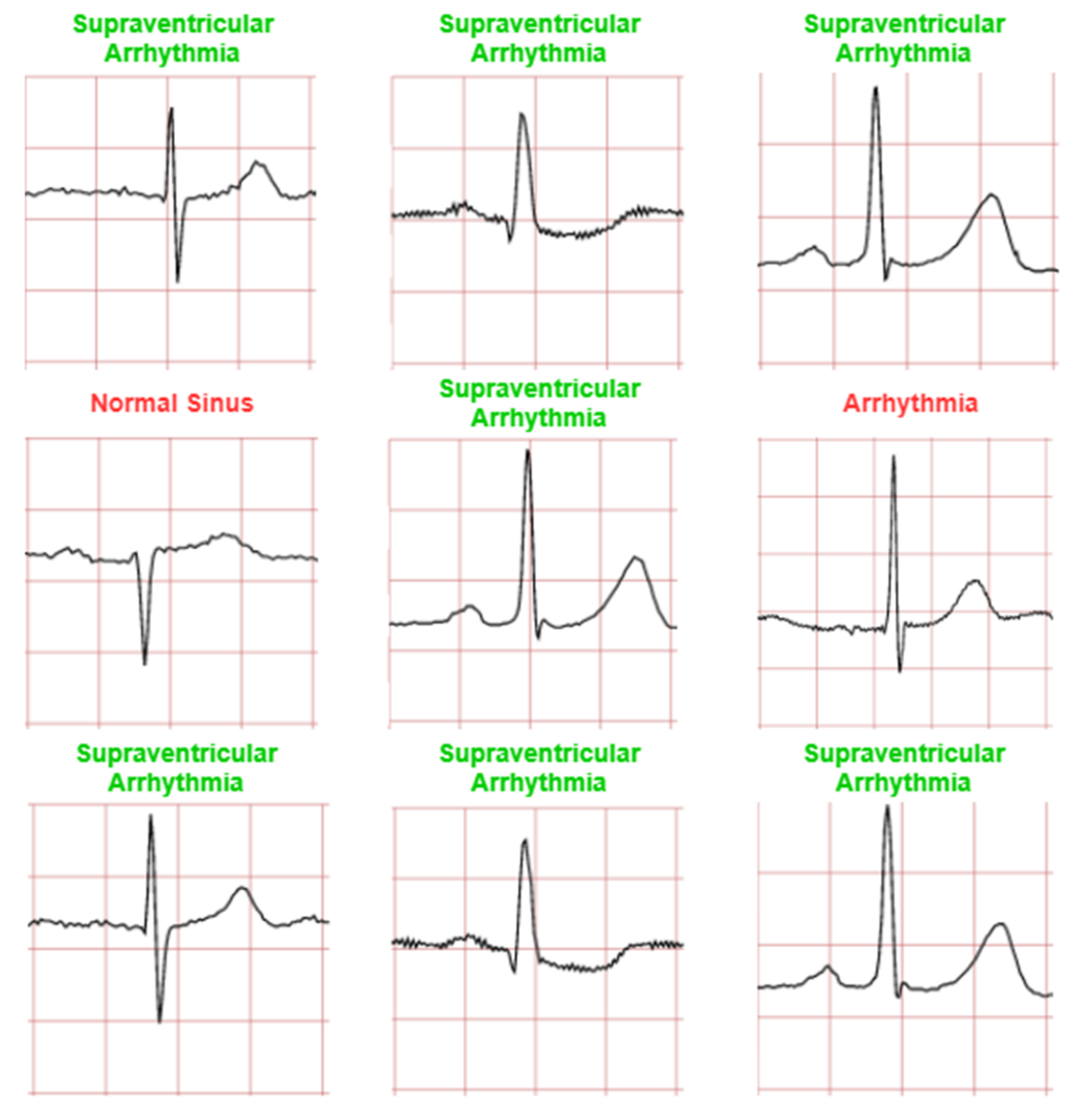 Diagnostics 12 00795 g014