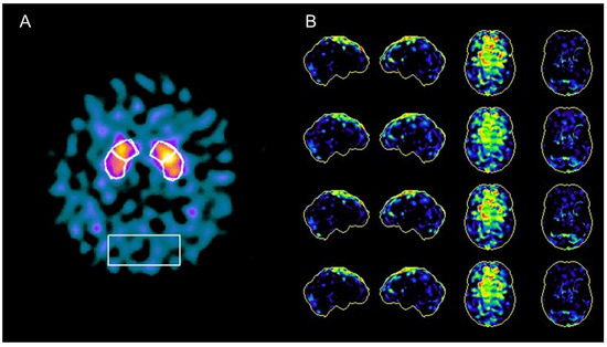 Diagnostics 12 00849 g002 550