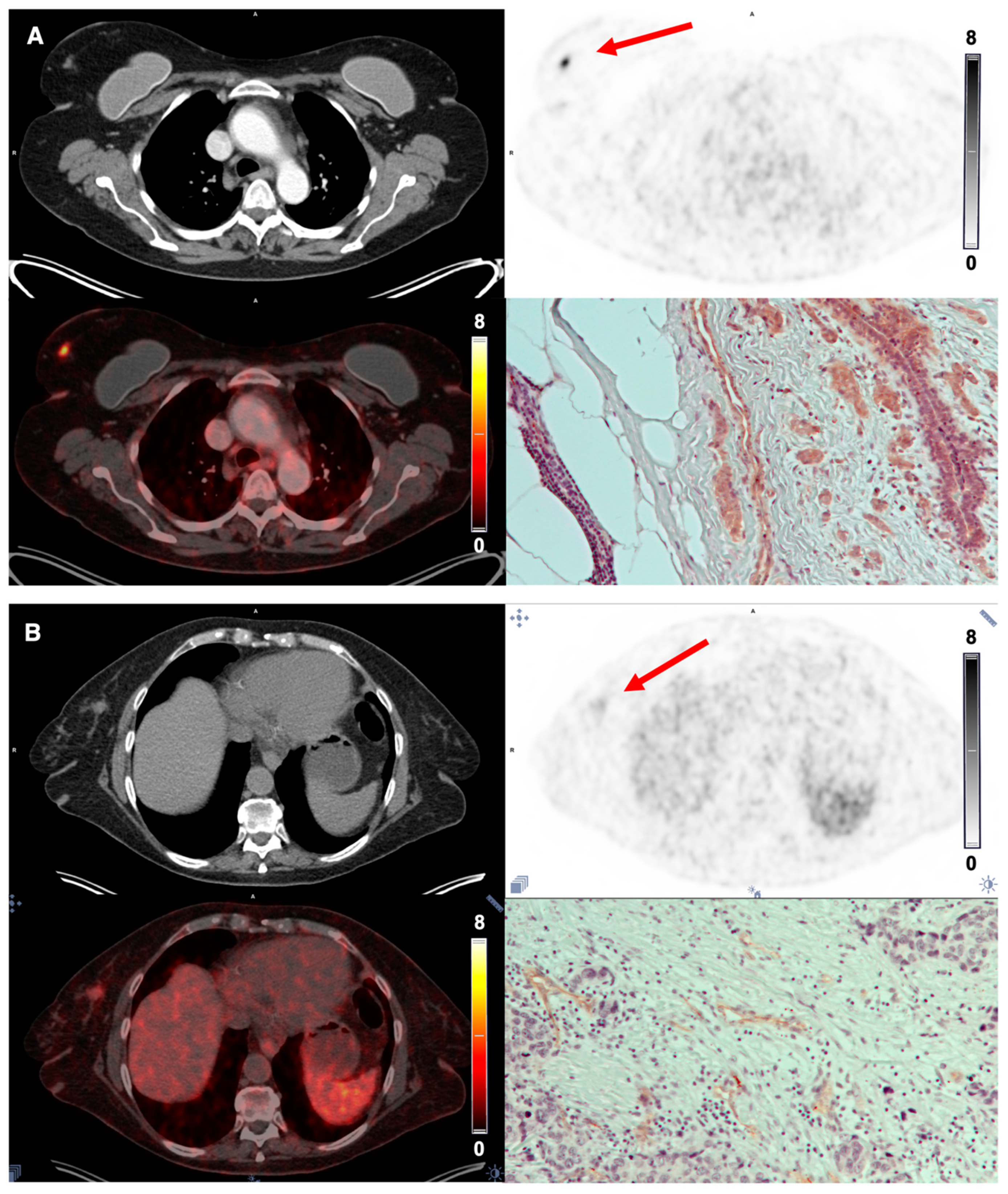 Diagnostics 12 00851 g005