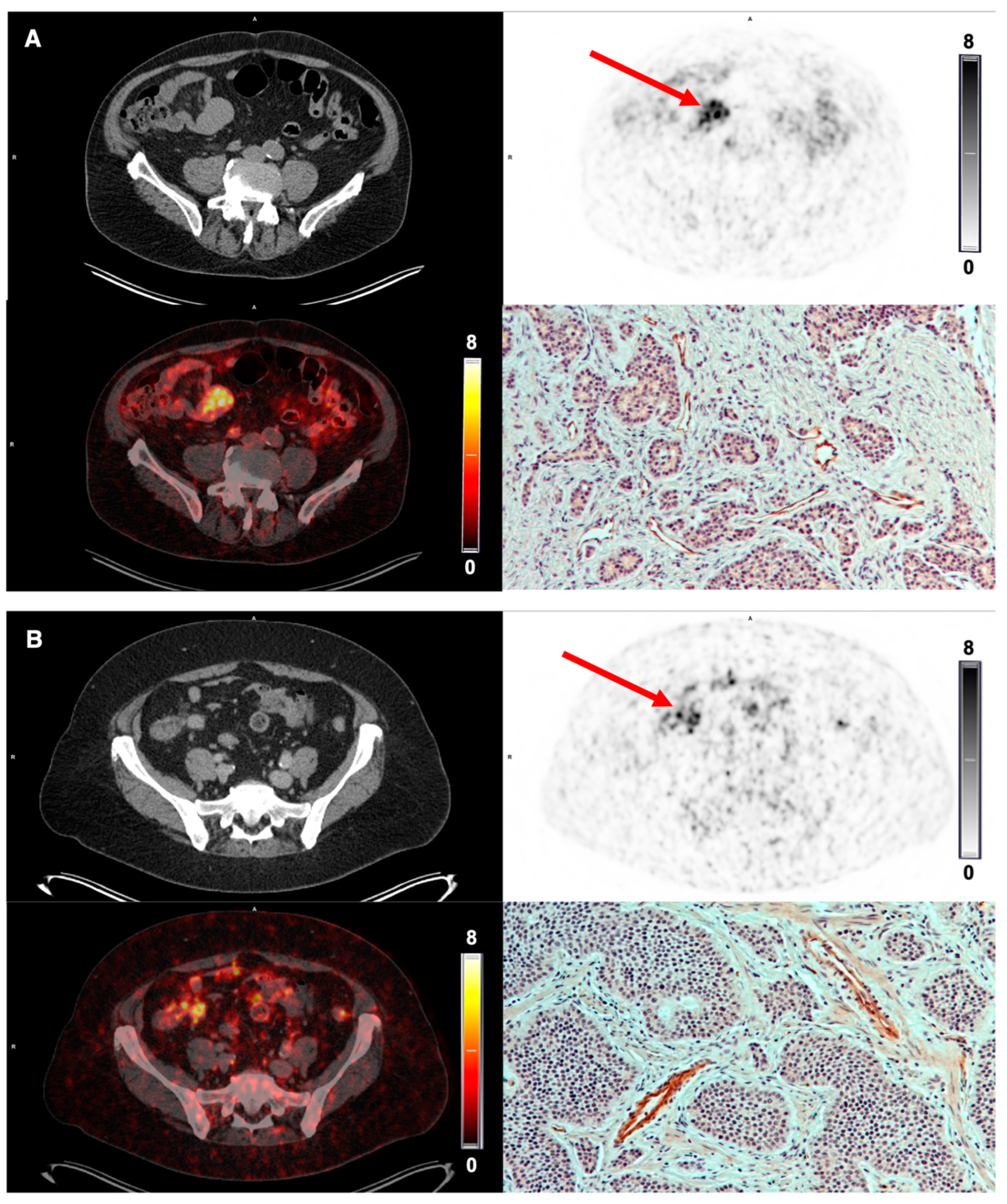Diagnostics 12 00851 g006