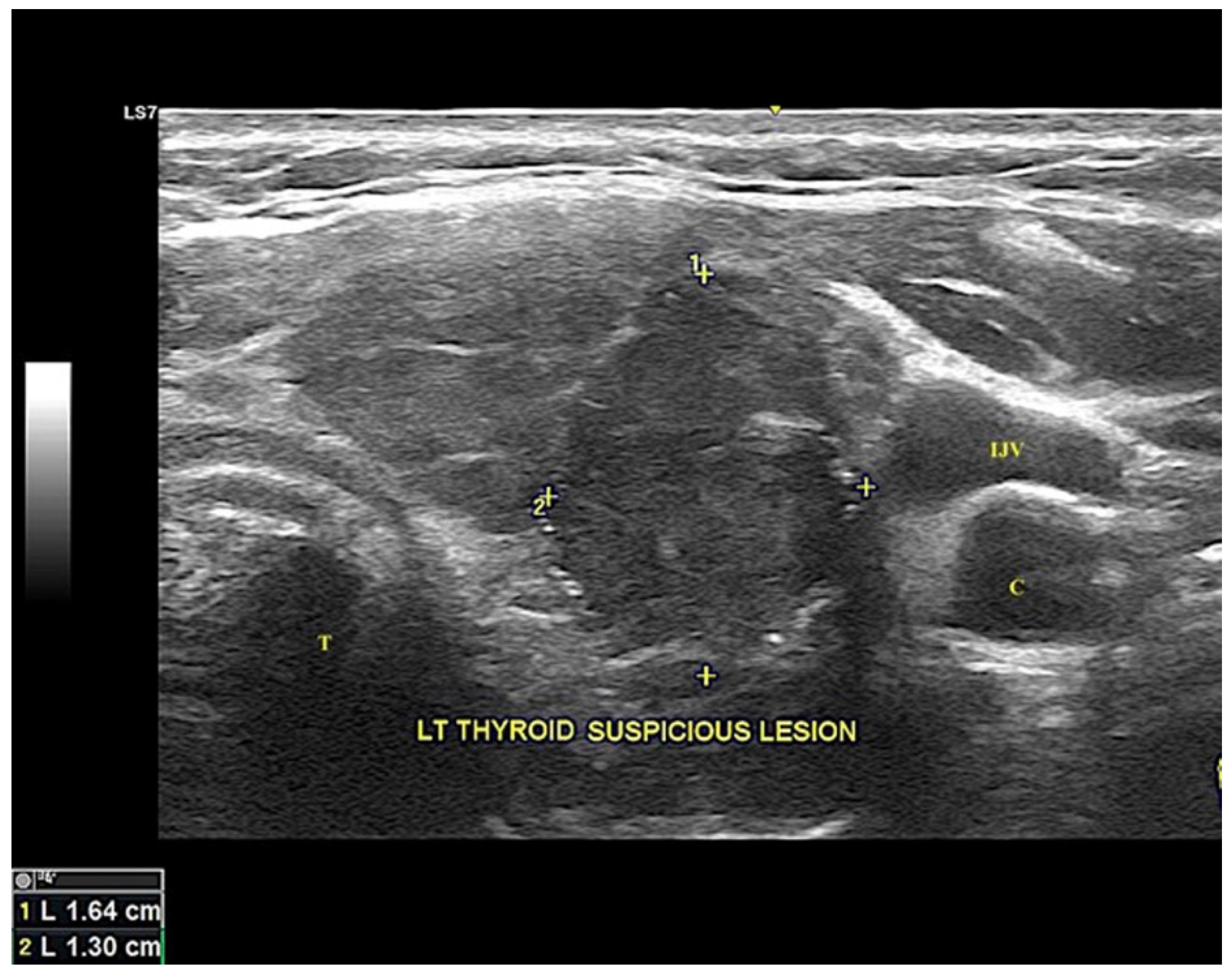 Diagnostics 12 00855 g001