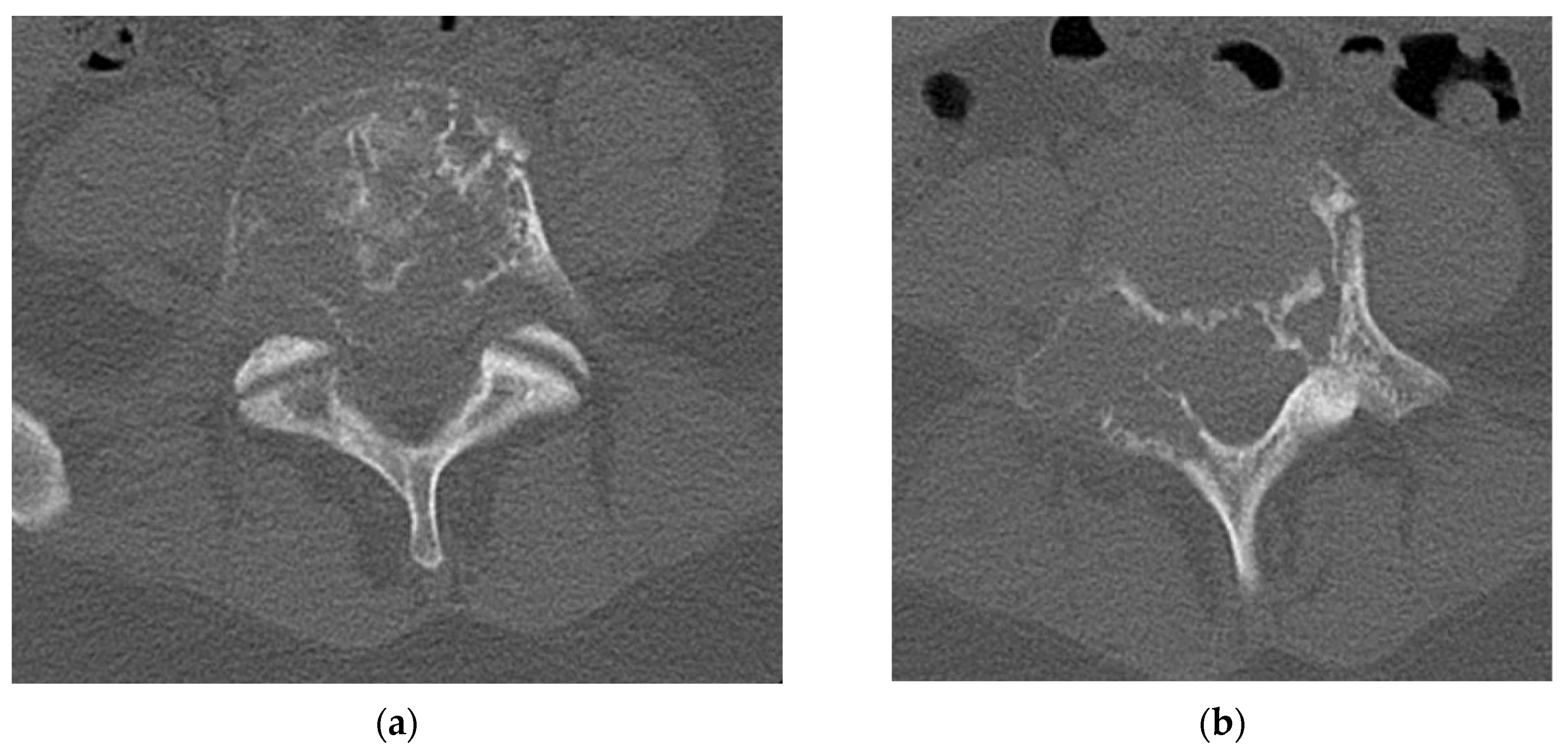 Diagnostics 12 00857 g002a