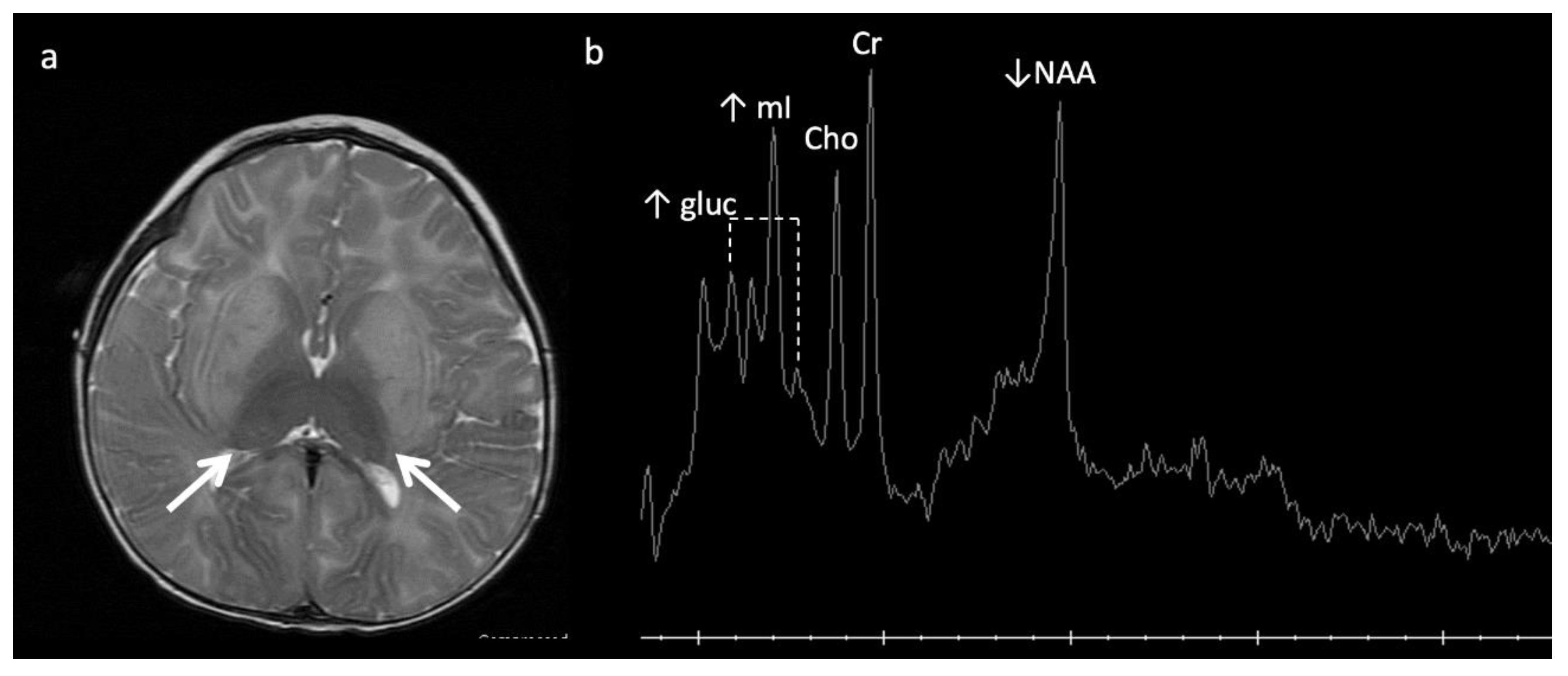 Diagnostics 12 00861 g005