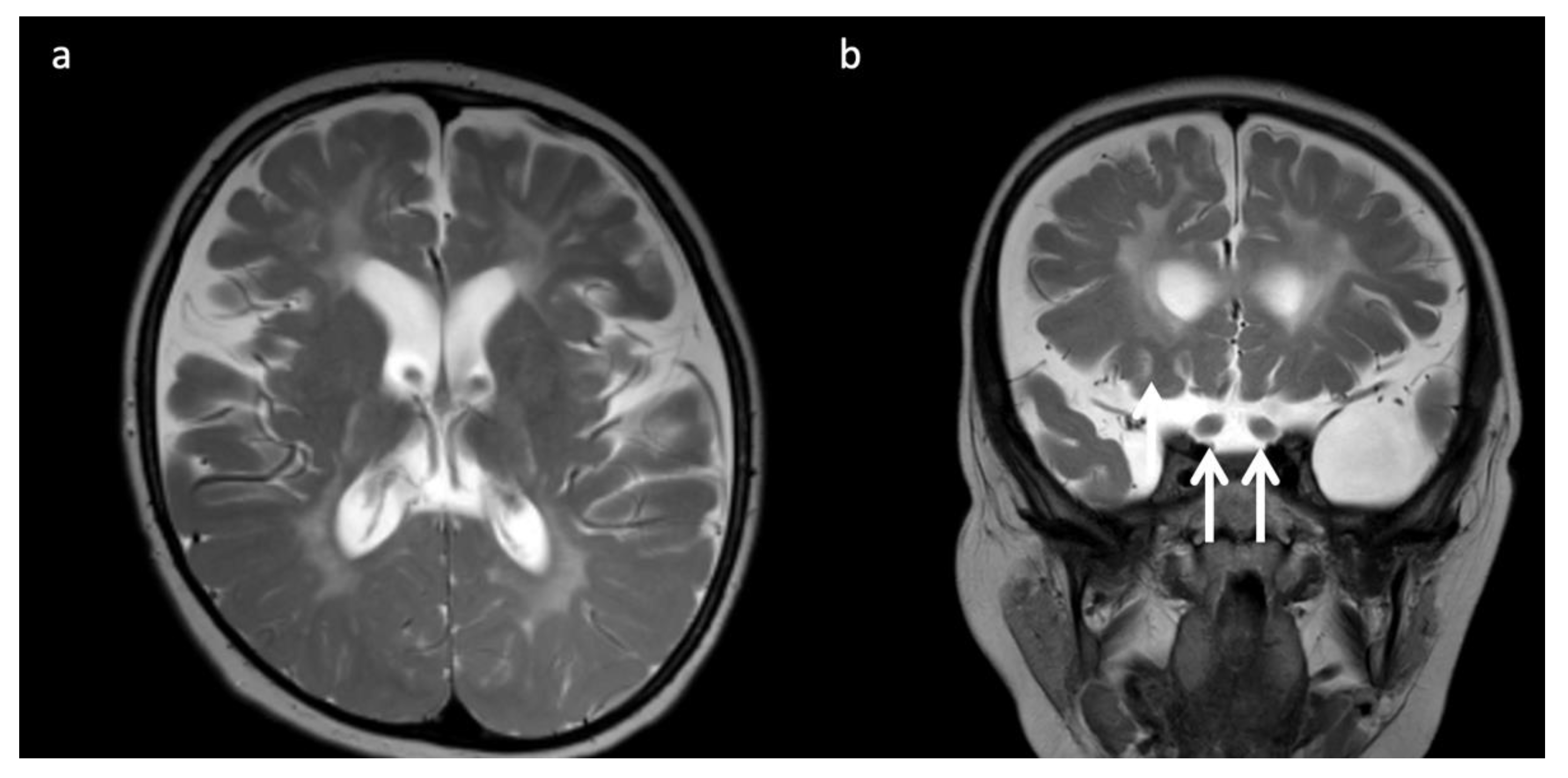 Diagnostics 12 00861 g006