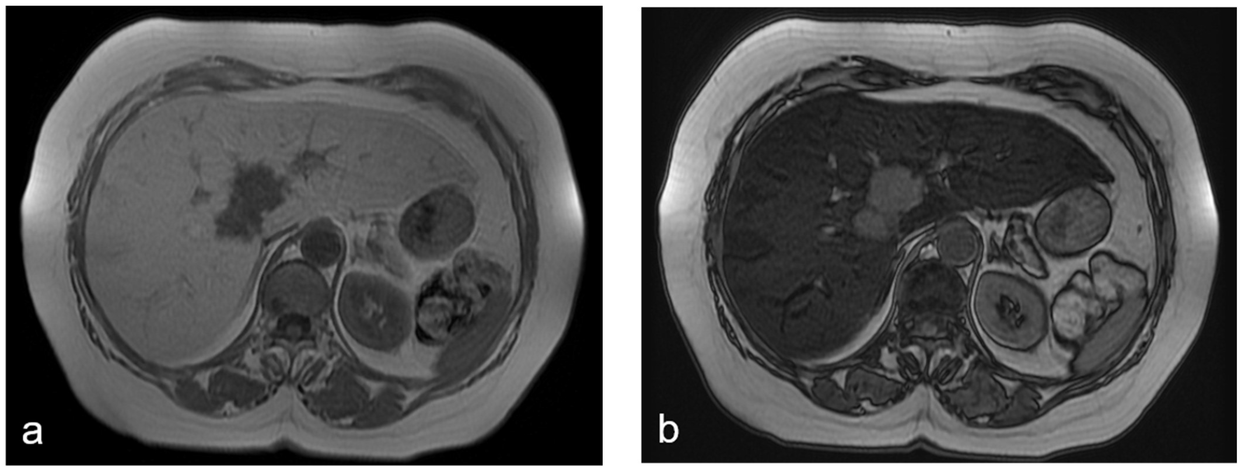 Diagnostics 12 00867 g001a