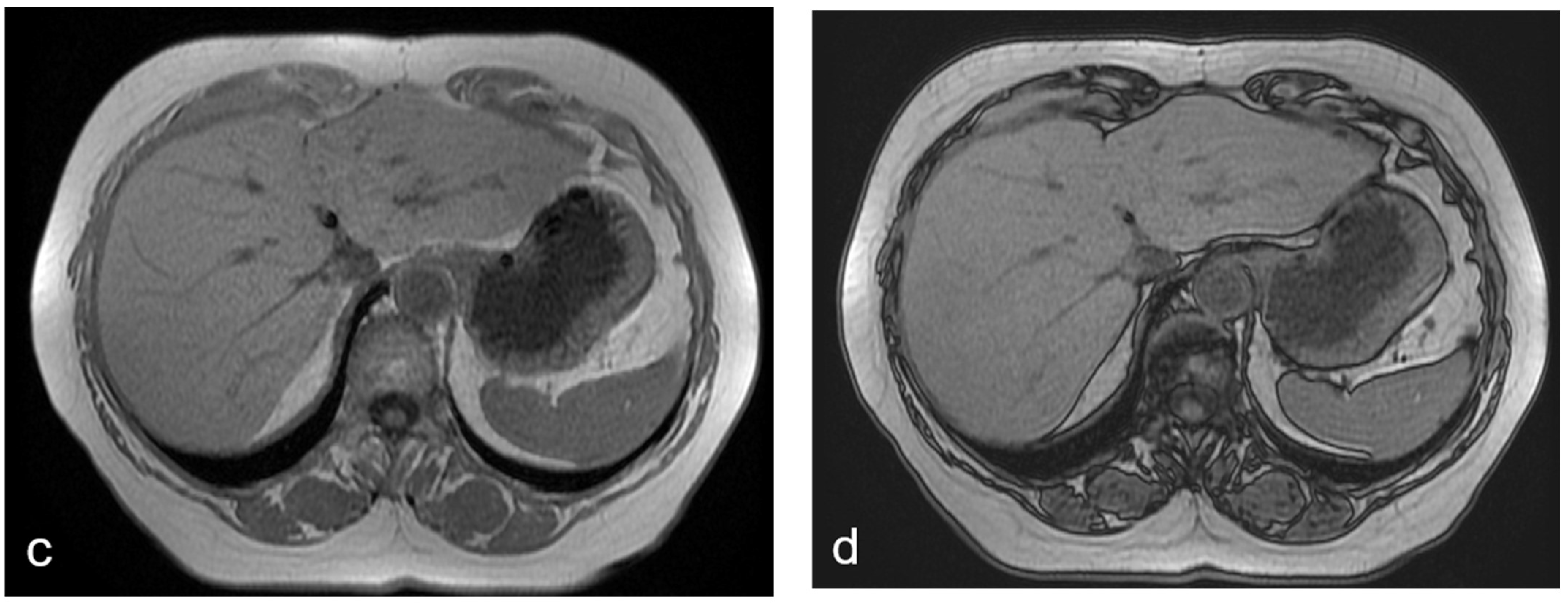 Diagnostics 12 00867 g001b