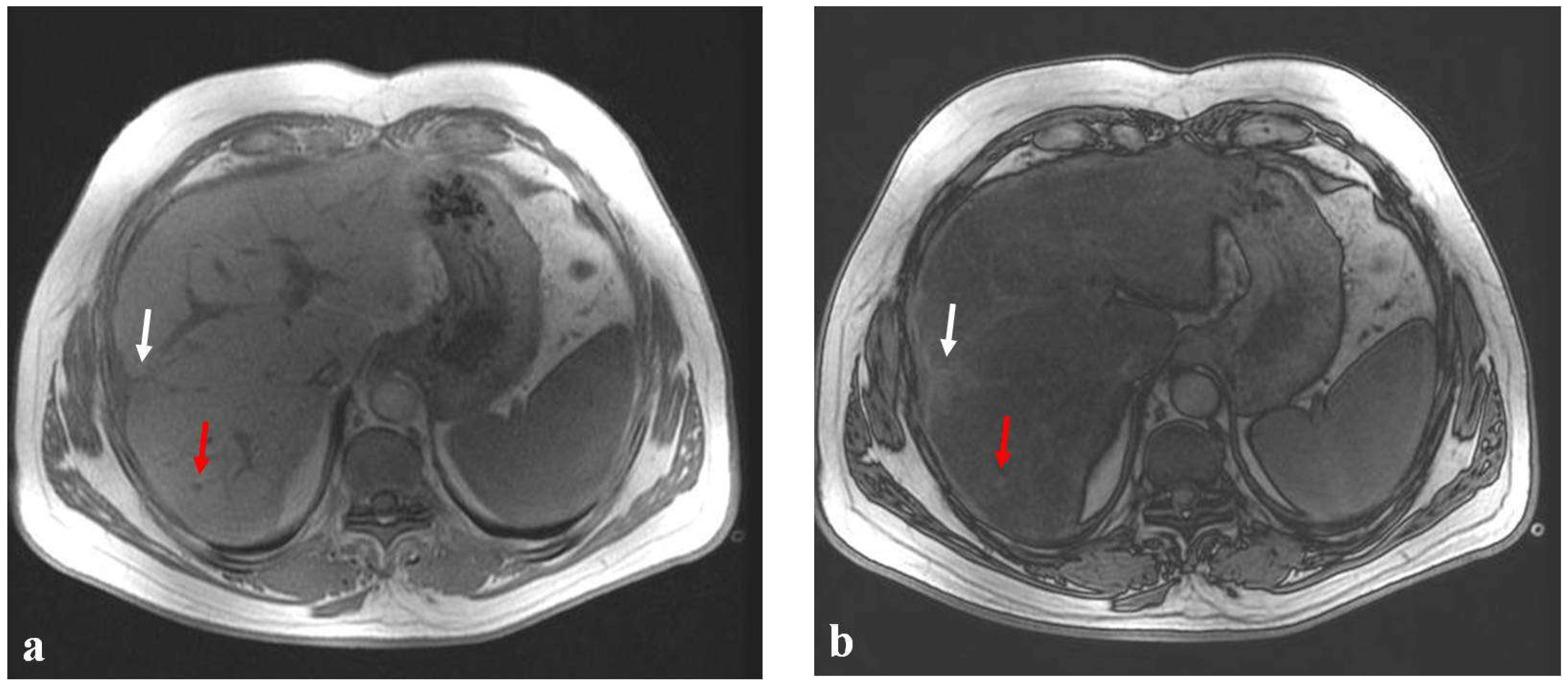 Diagnostics 12 00867 g002a