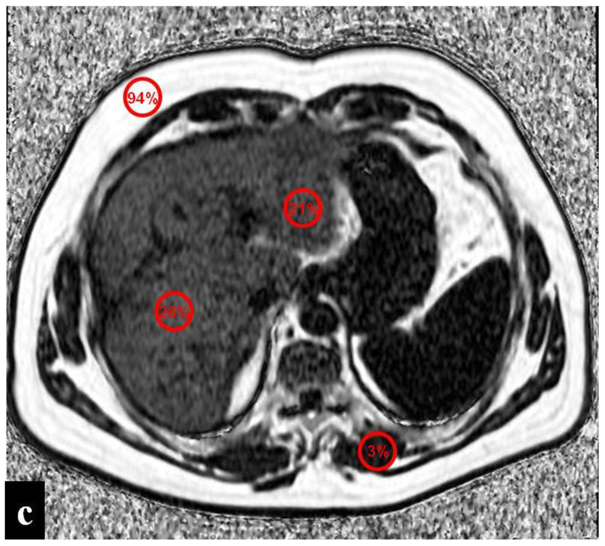 Diagnostics 12 00867 g002b