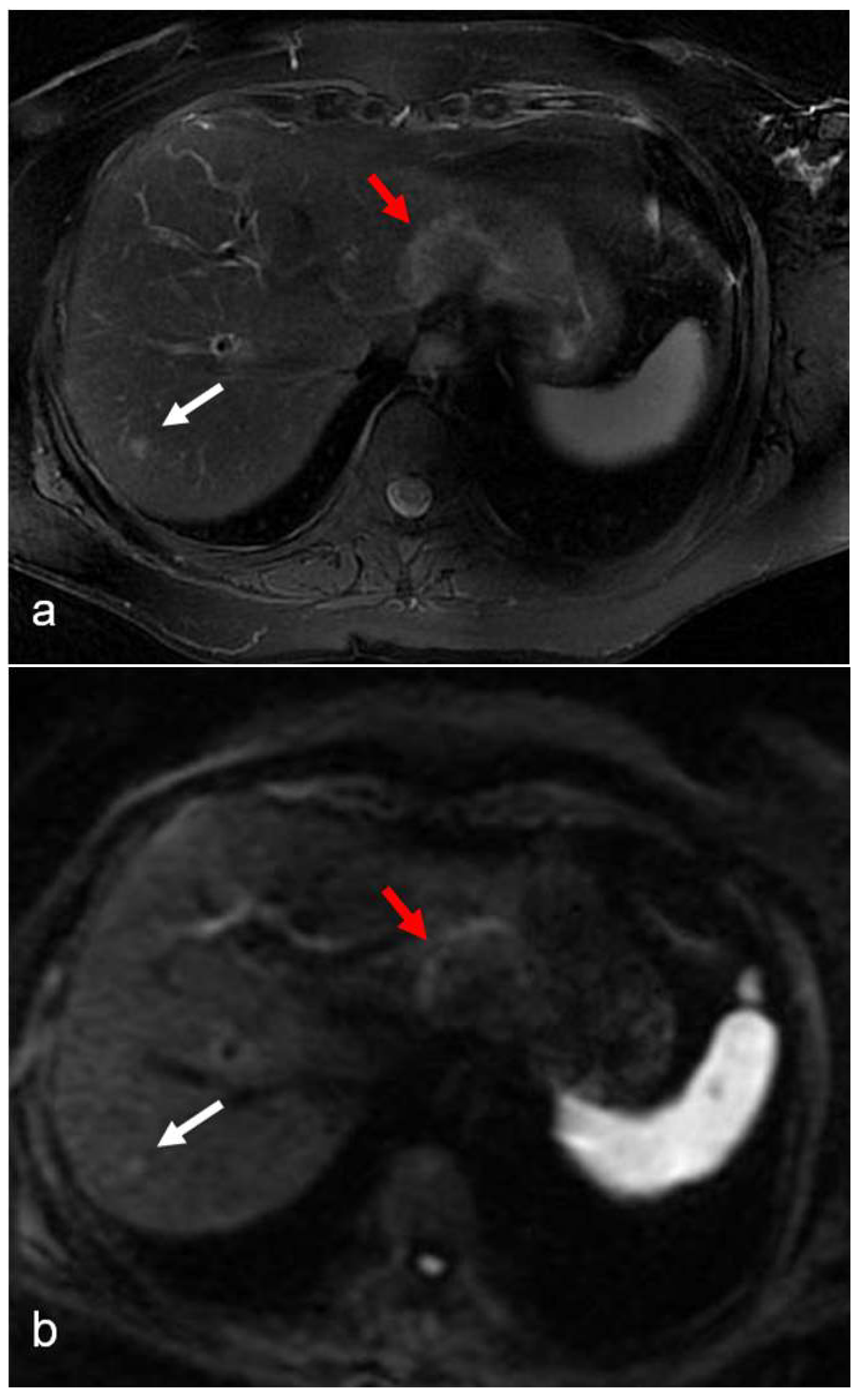 Diagnostics 12 00867 g003a