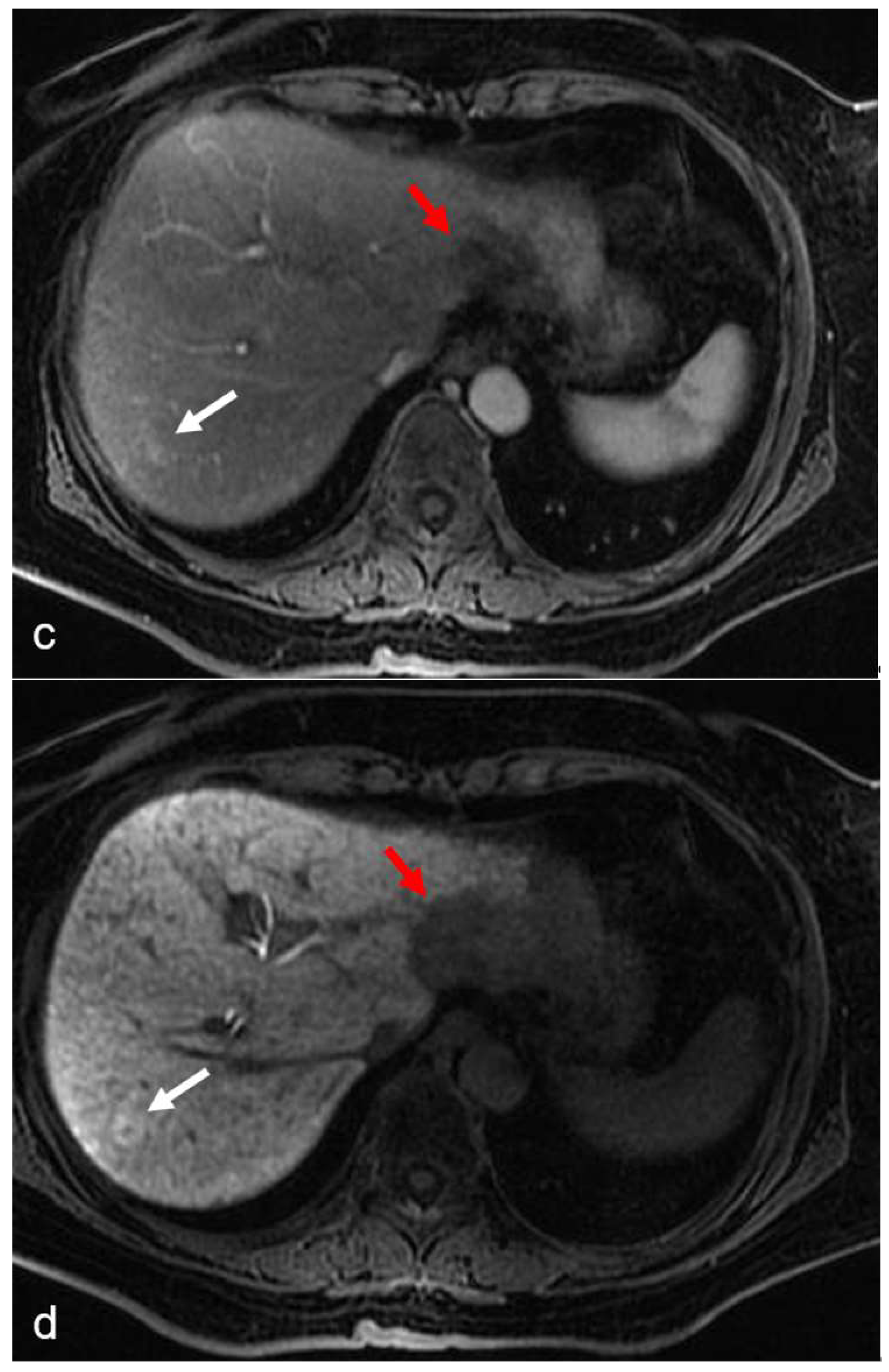 Diagnostics 12 00867 g003b