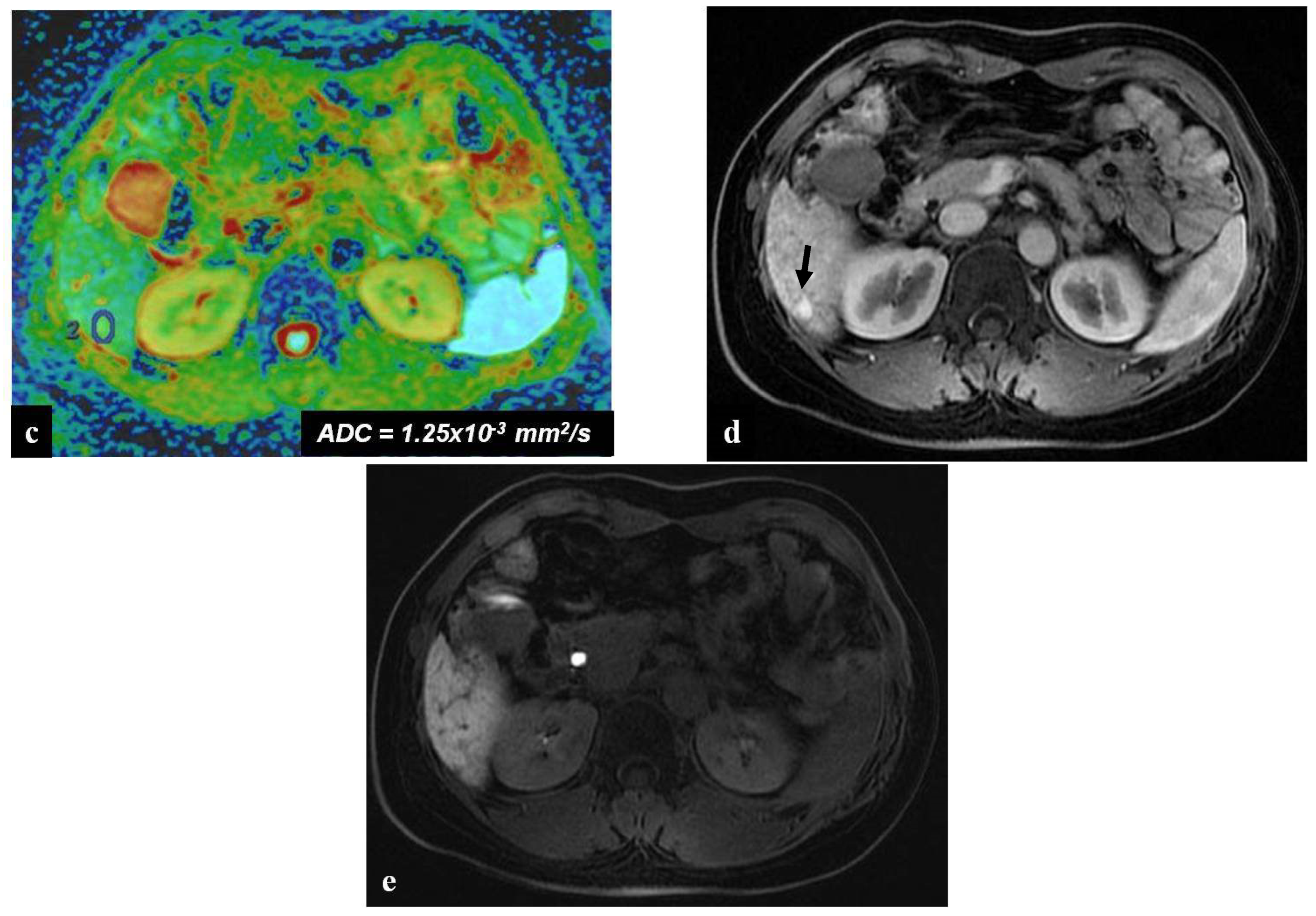 Diagnostics 12 00867 g004b