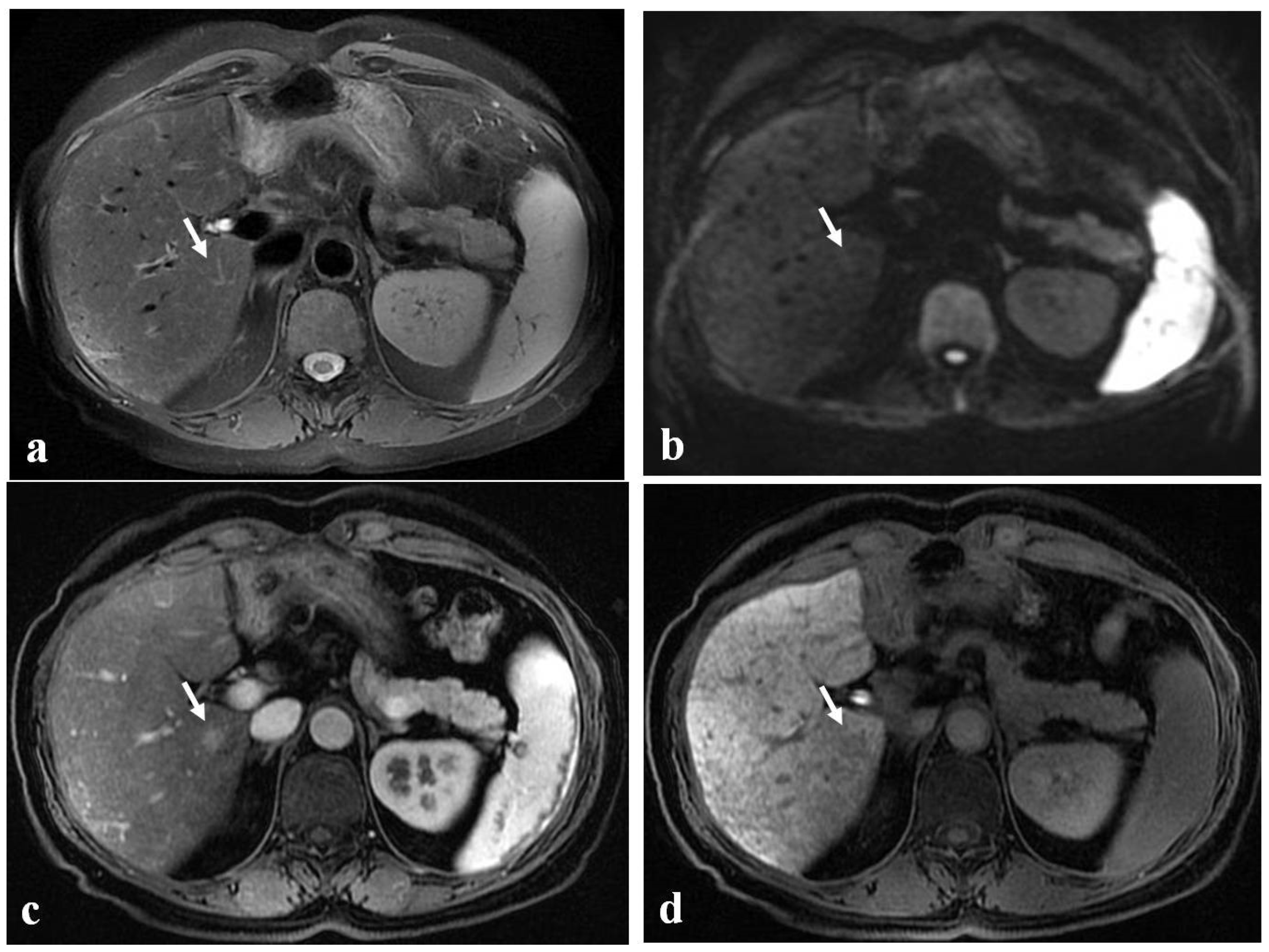 Diagnostics 12 00867 g006