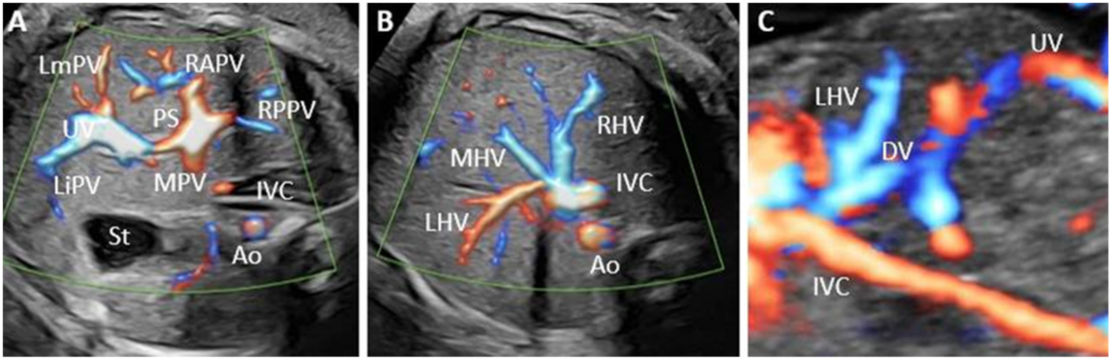 Diagnostics 12 00873 g001
