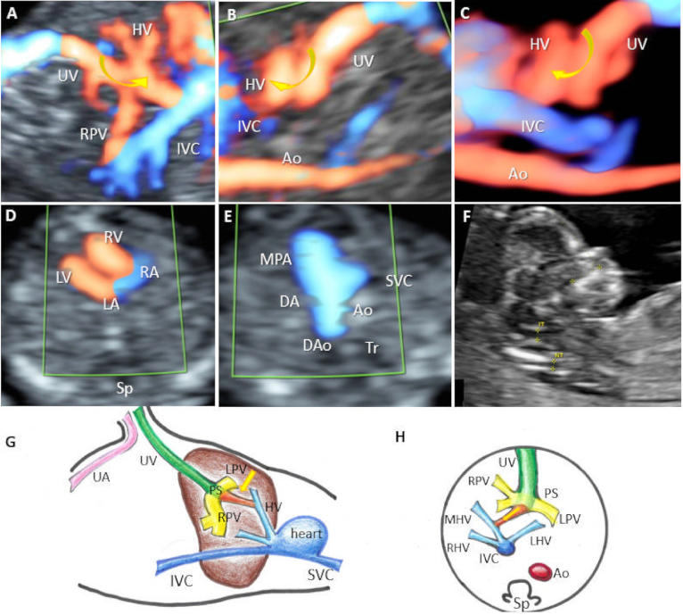 Diagnostics 12 00873 g004
