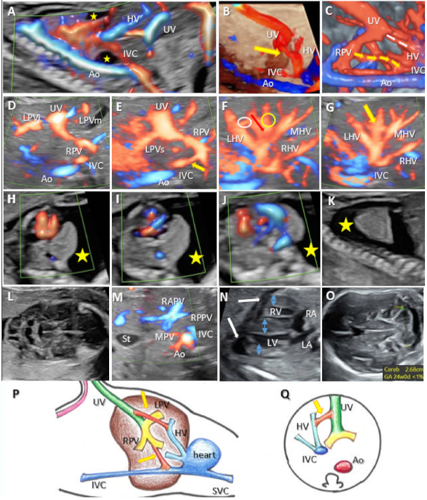 Diagnostics 12 00873 g006