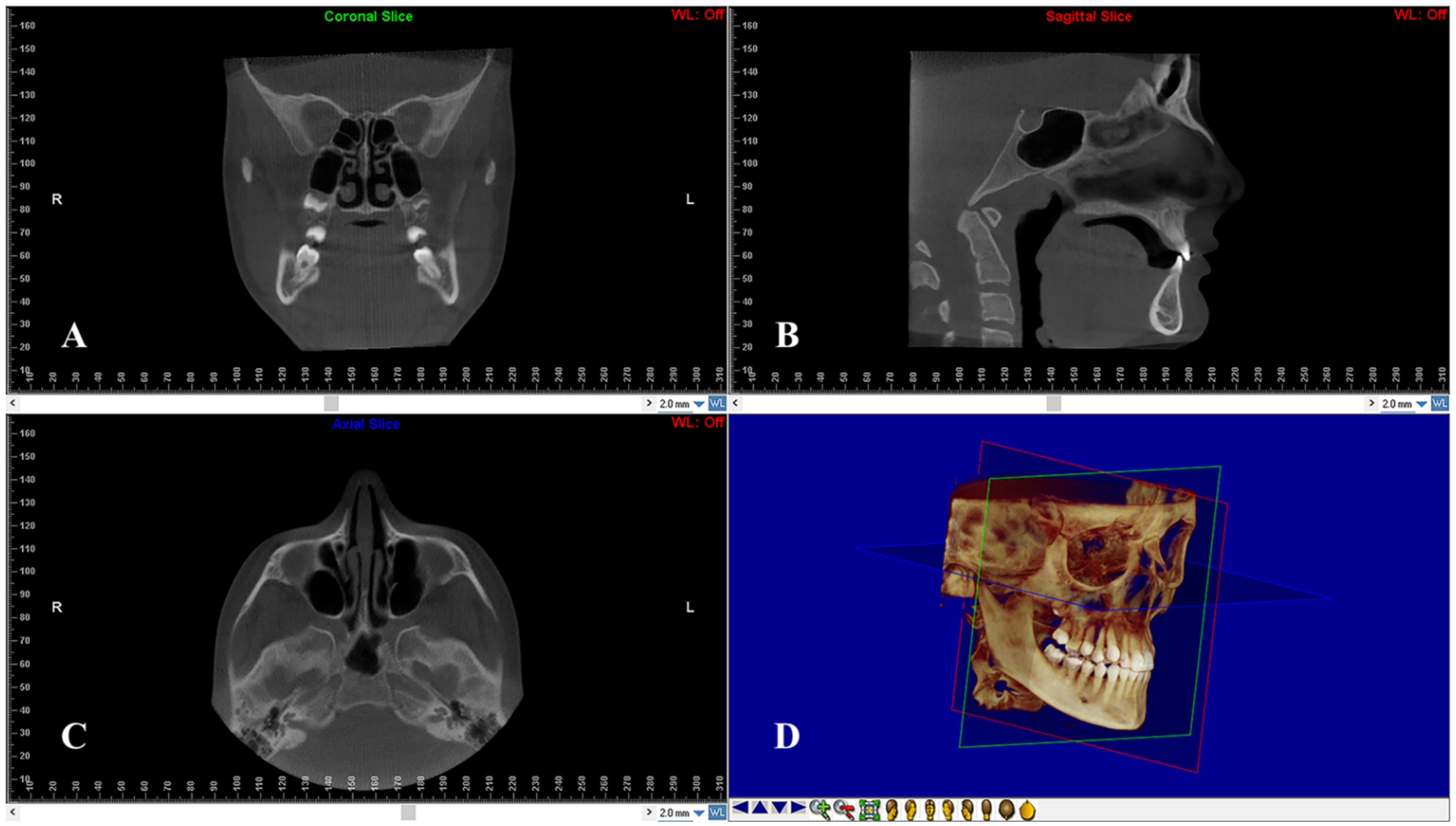Diagnostics 12 00875 g002
