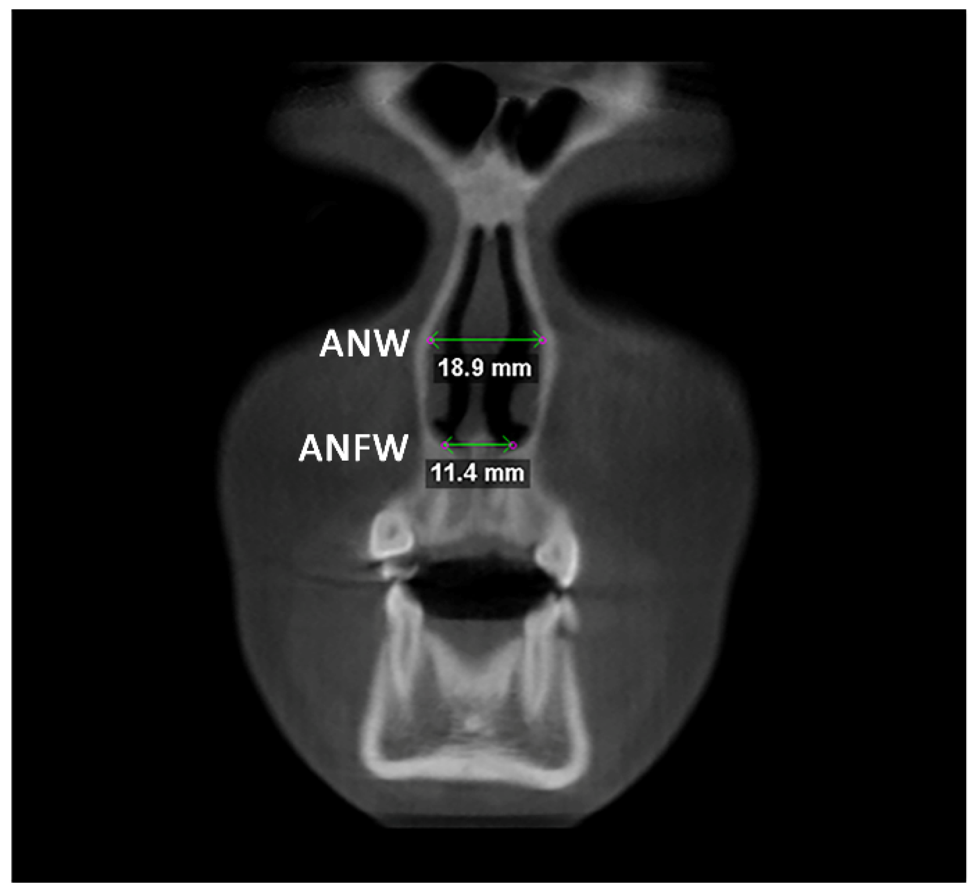 Diagnostics 12 00875 g003