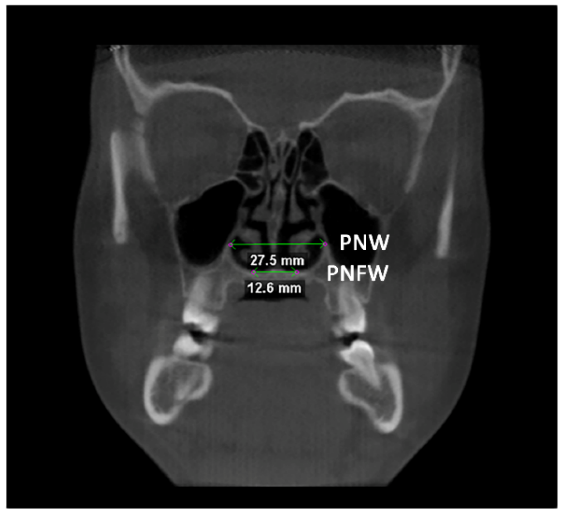 Diagnostics 12 00875 g004