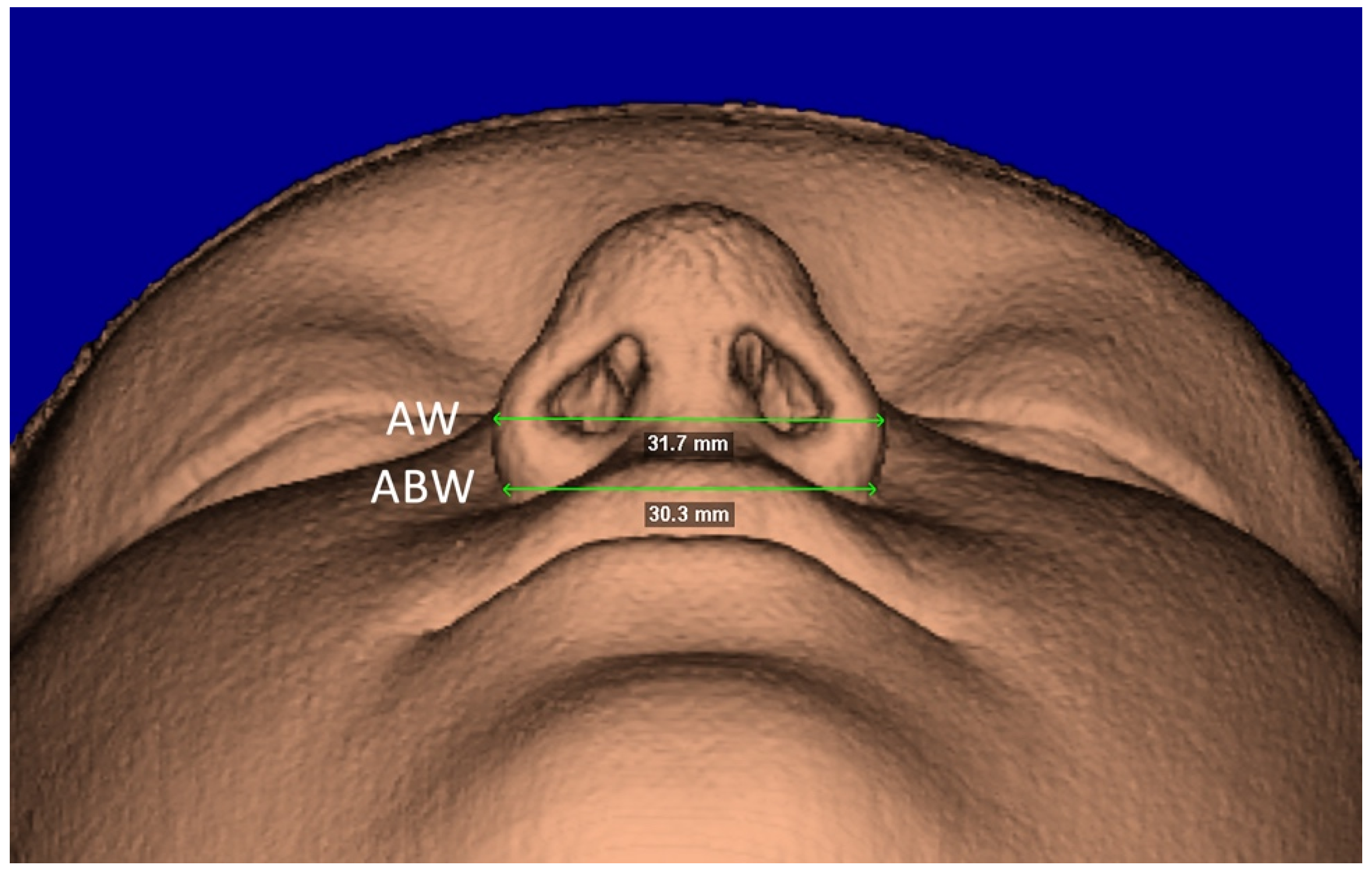 Diagnostics 12 00875 g005