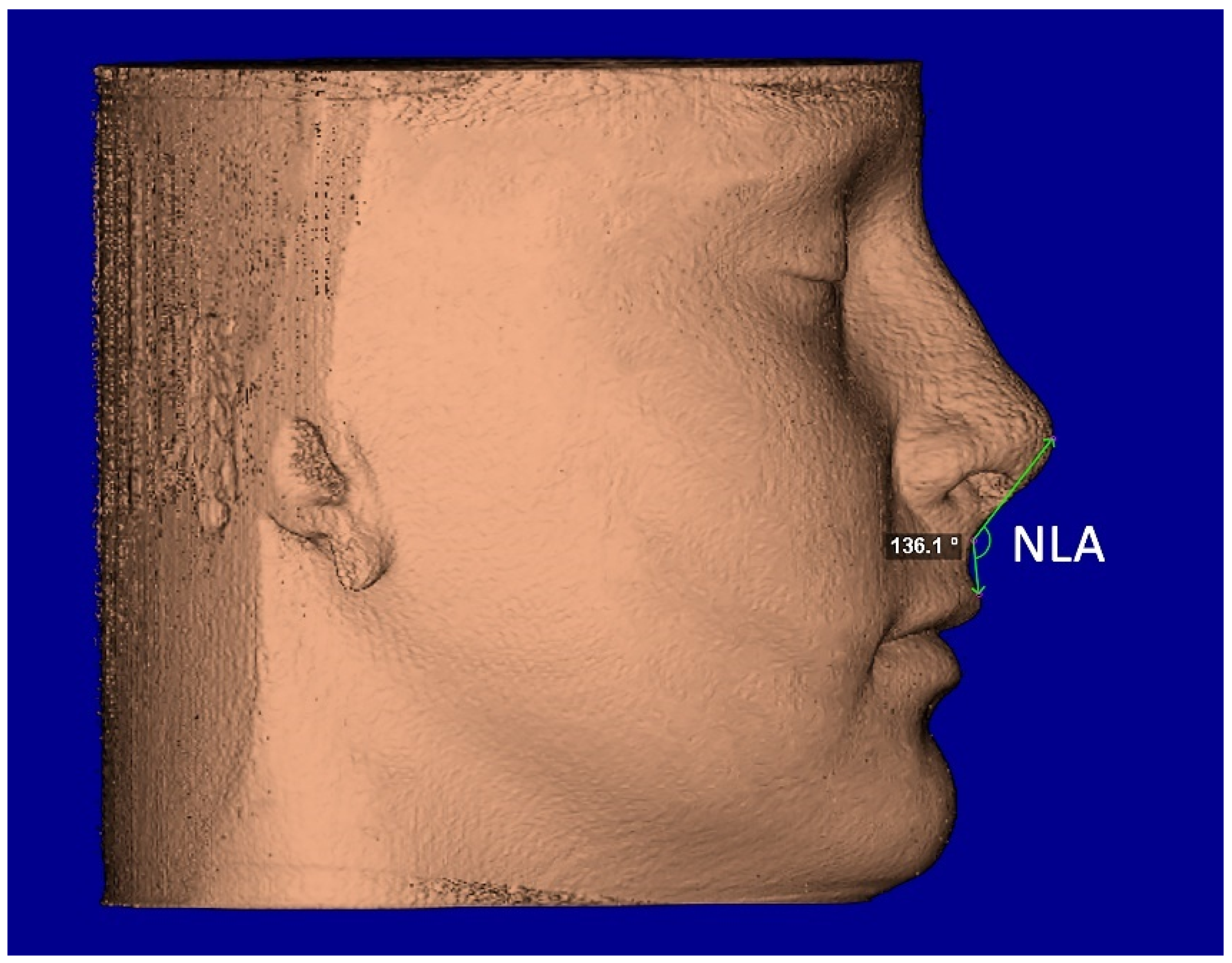 Diagnostics 12 00875 g007