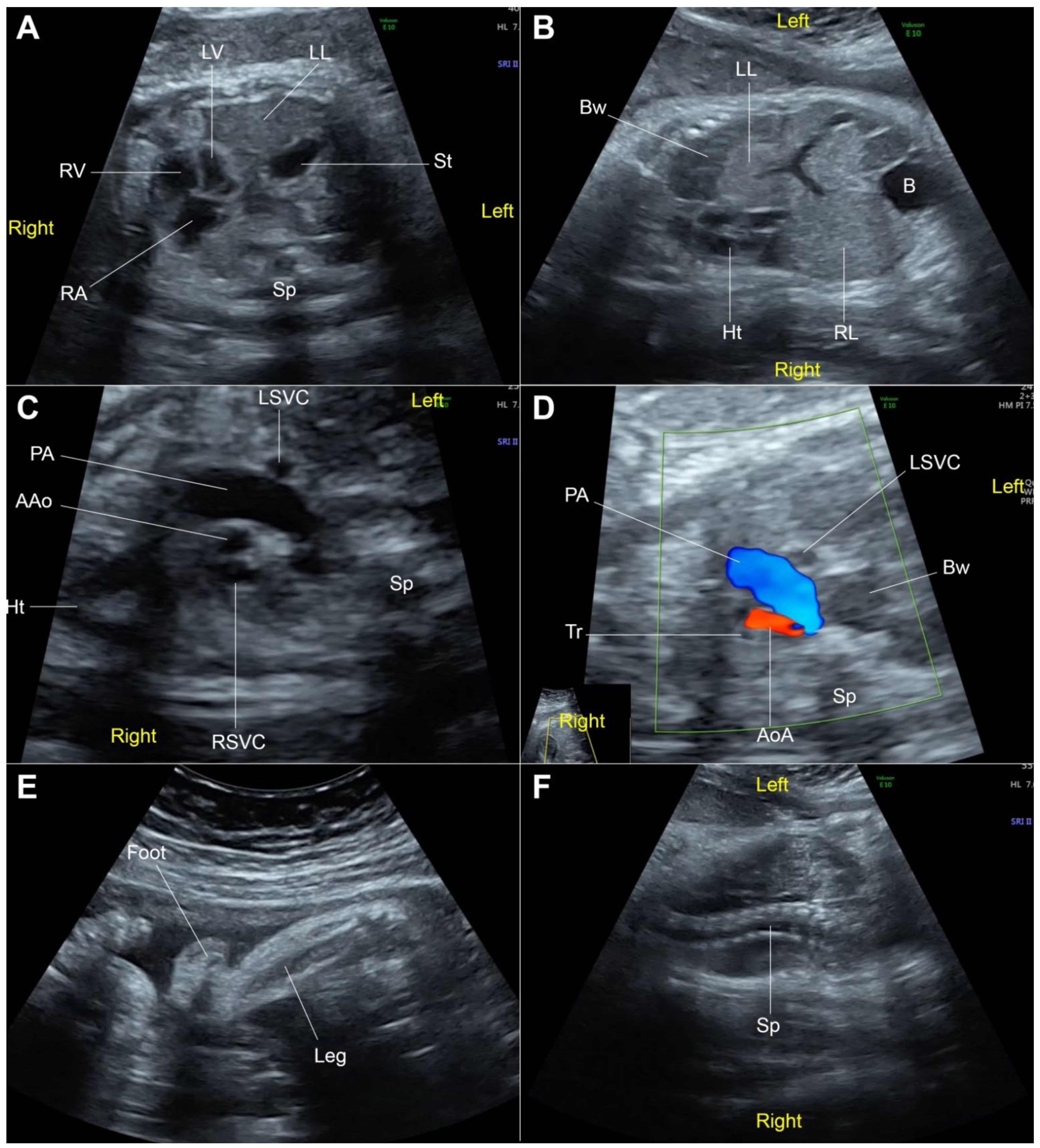 Diagnostics 12 00885 g001
