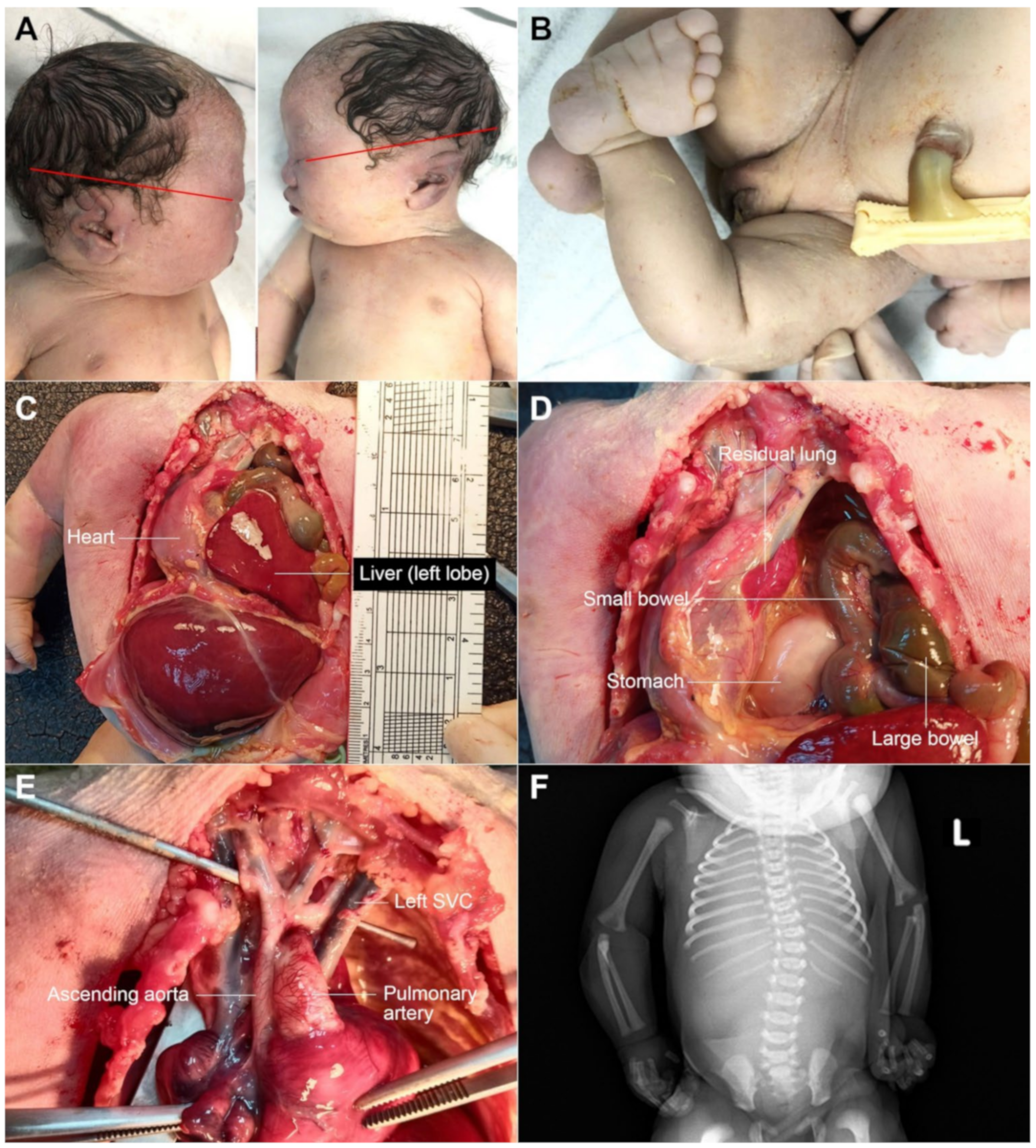 Diagnostics 12 00885 g003