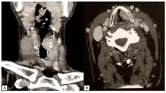 Diagnostics 12 00892 g001