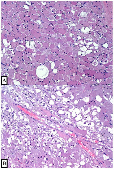 Diagnostics 12 00892 g003