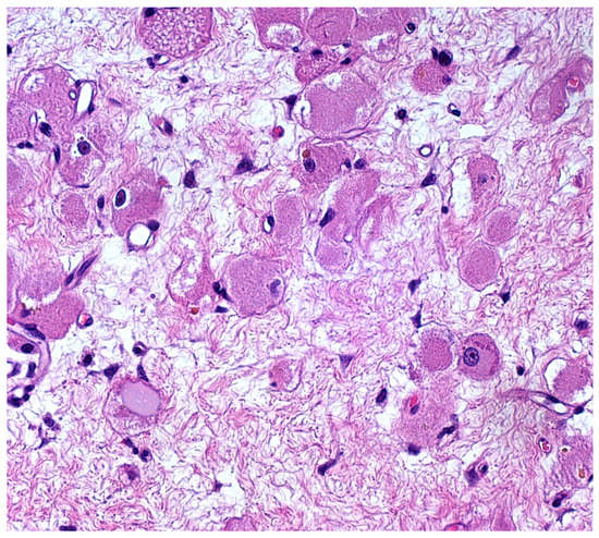 Diagnostics 12 00892 g004