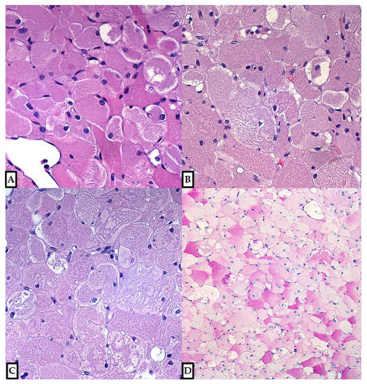 Diagnostics 12 00892 g005