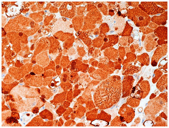 Diagnostics 12 00892 g006