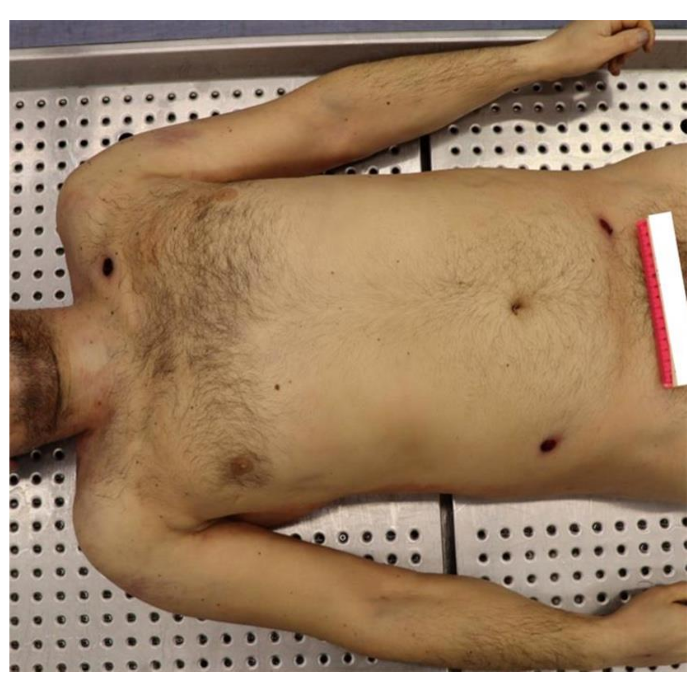 Diagnostics 12 00899 g001